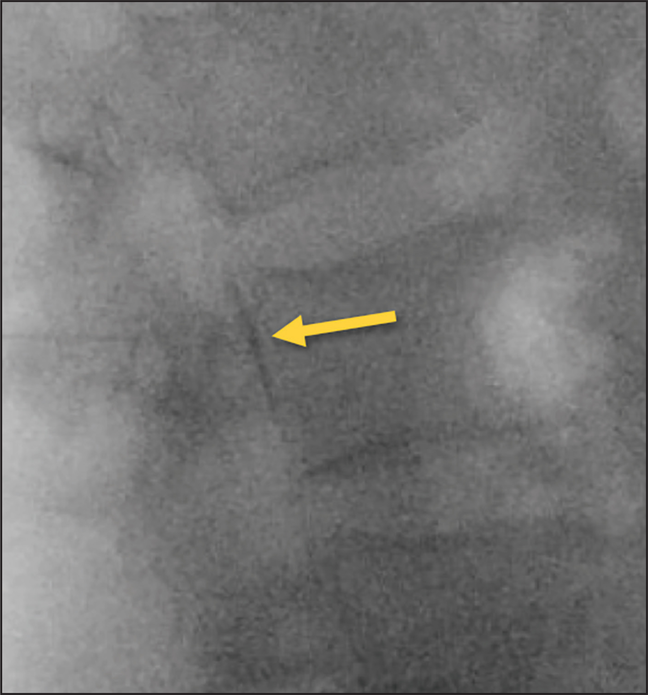 FIGURE 10.