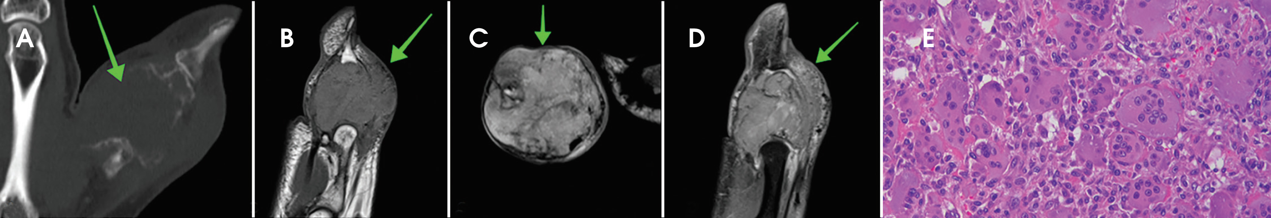 FIGURE 11.