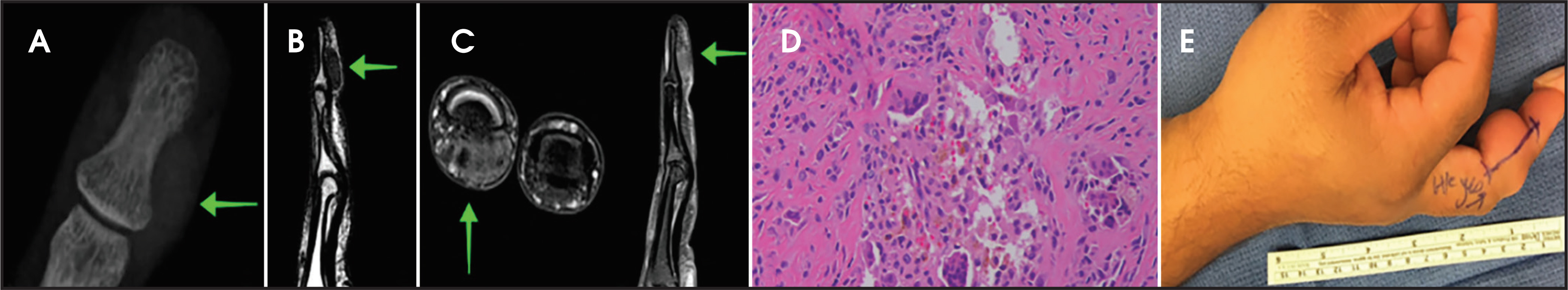 FIGURE 13.