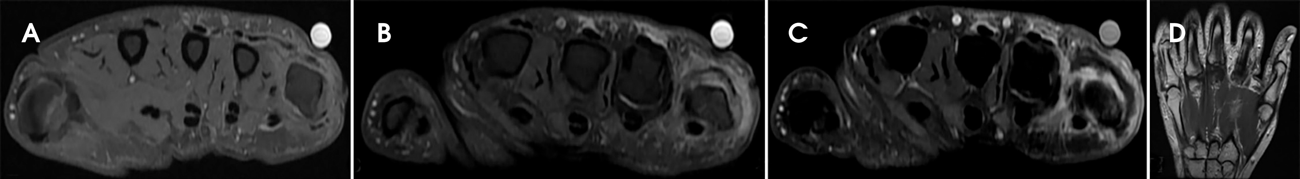 FIGURE 14.