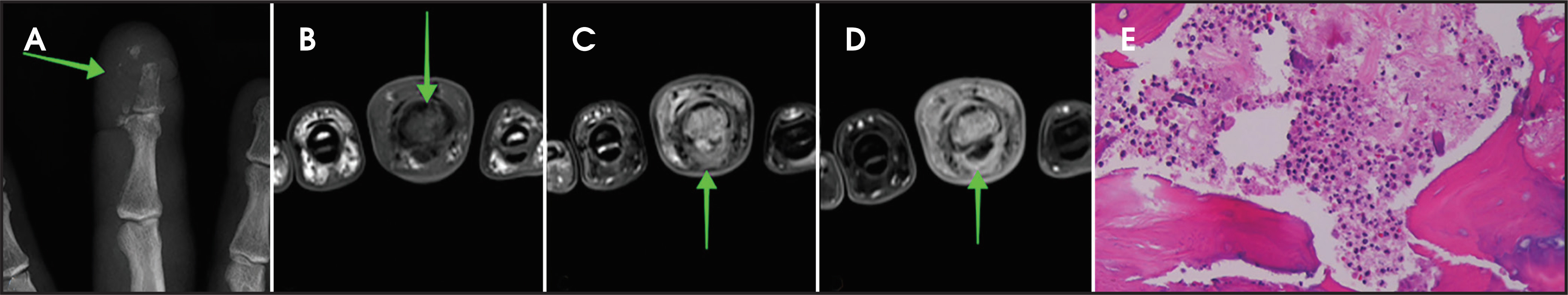 FIGURE 16.