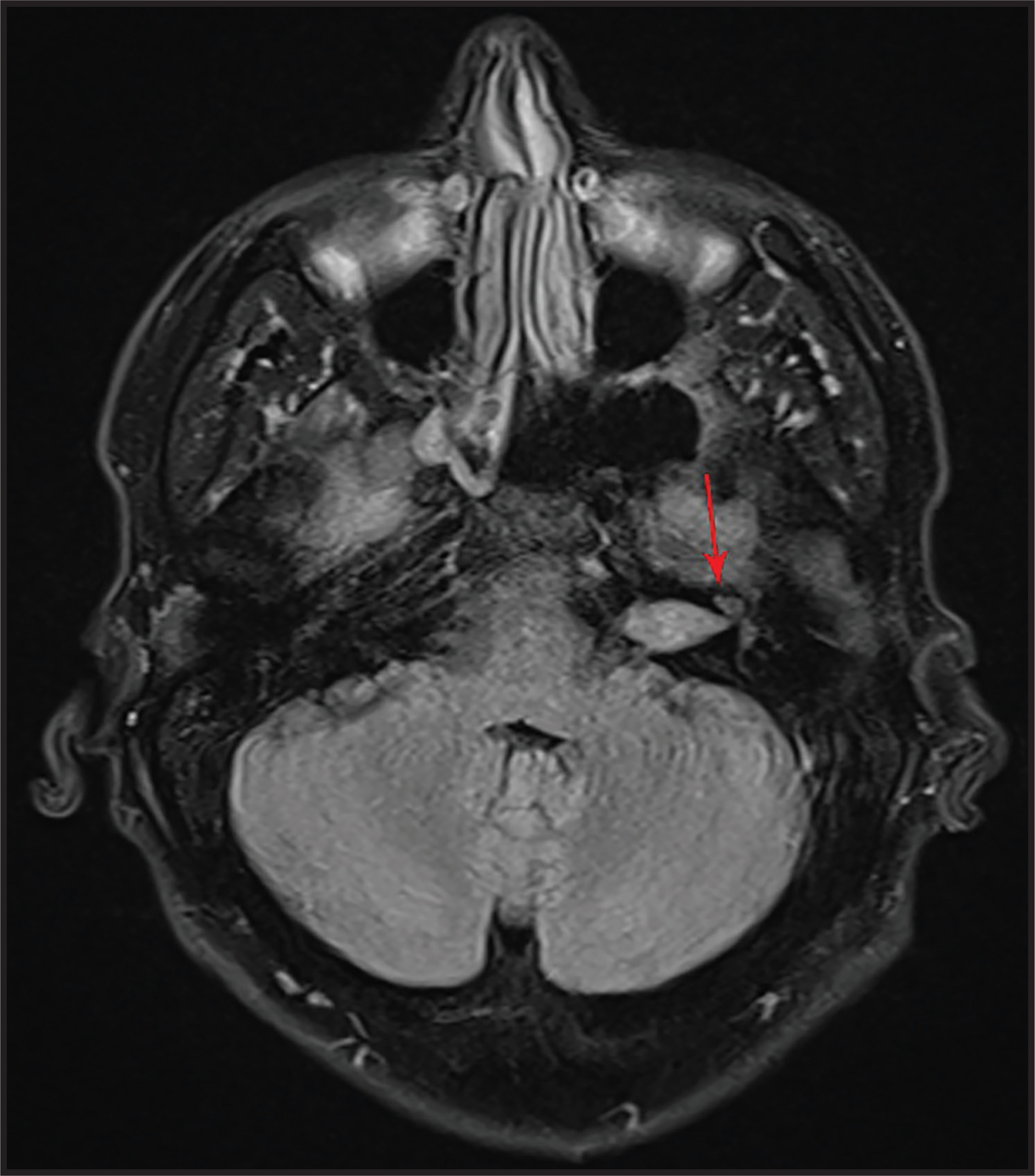 FIGURE 5.