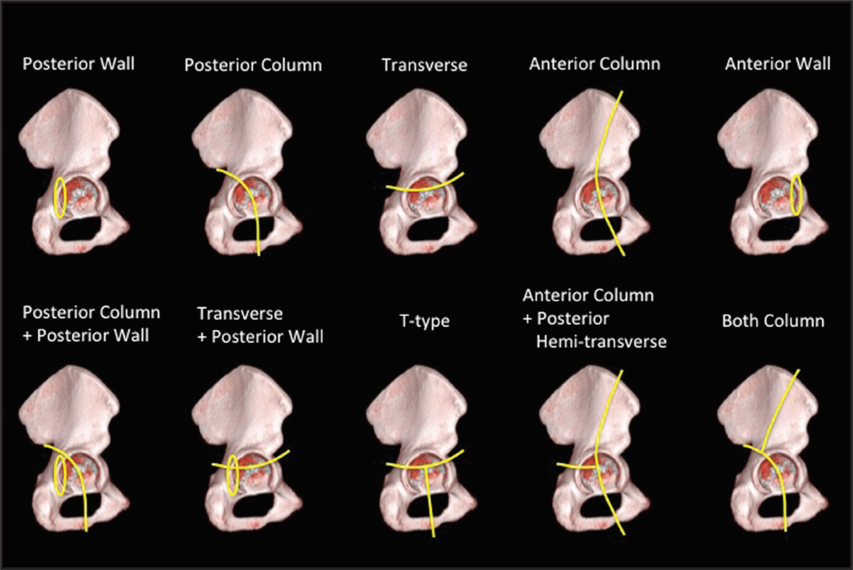 FIGURE 3.