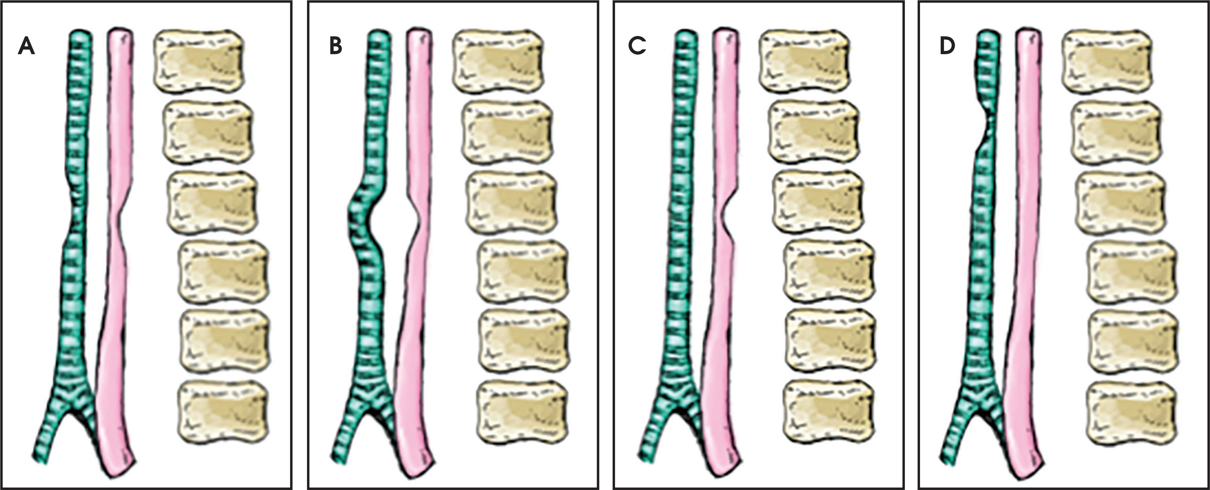 FIGURE 11.