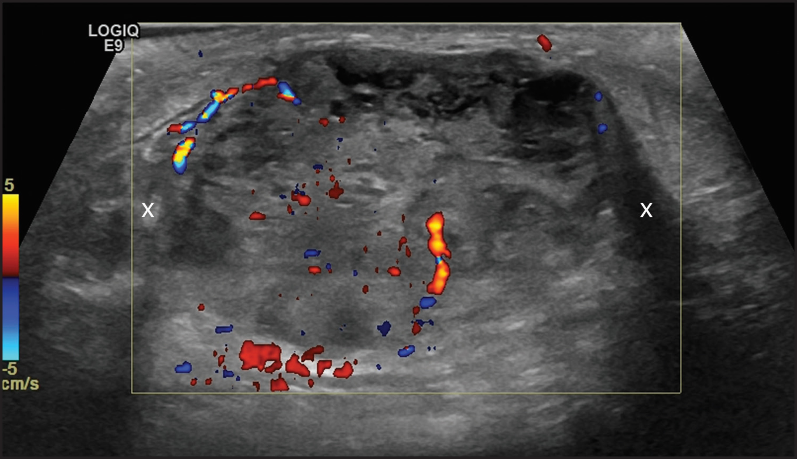 FIGURE 13