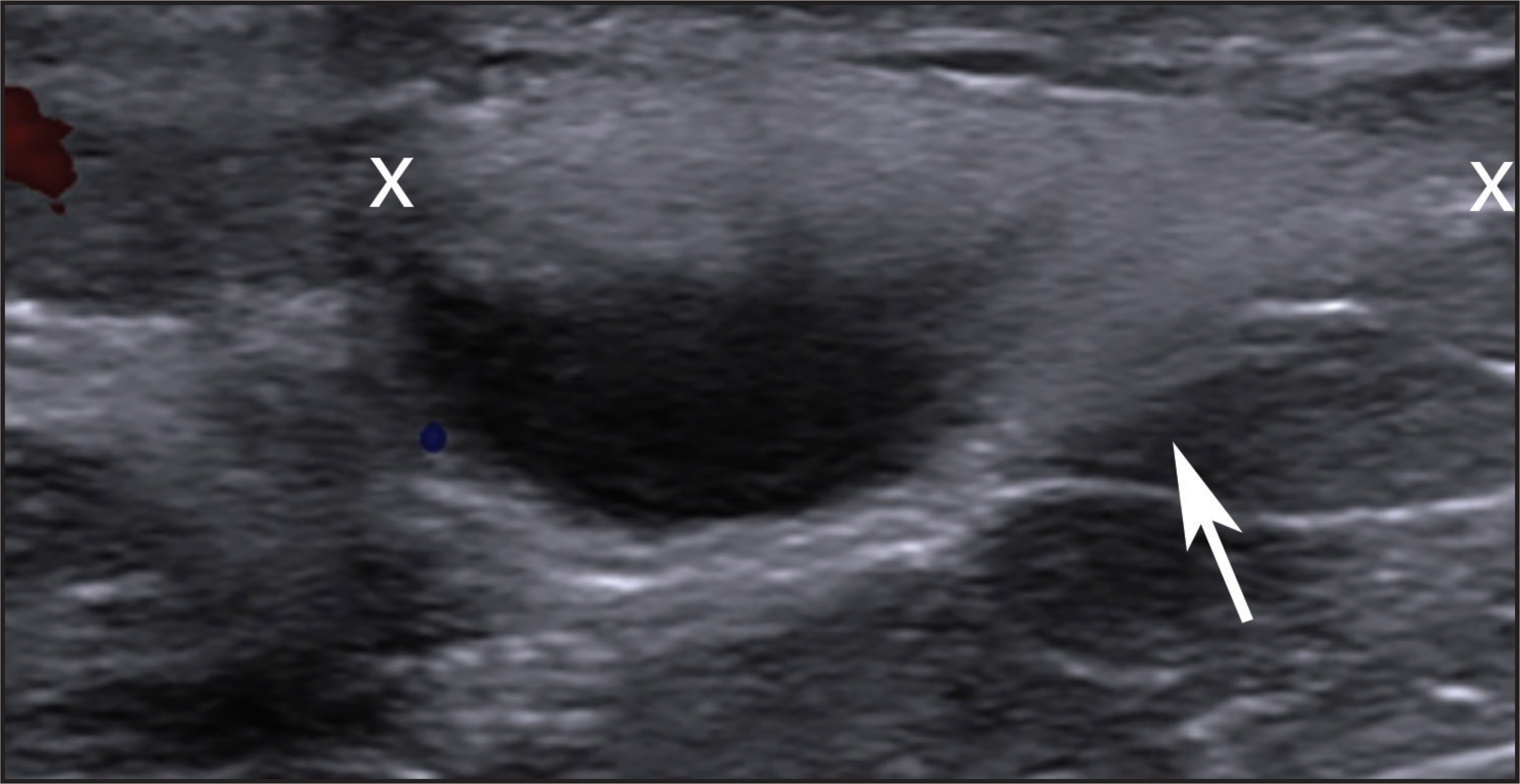 FIGURE 14