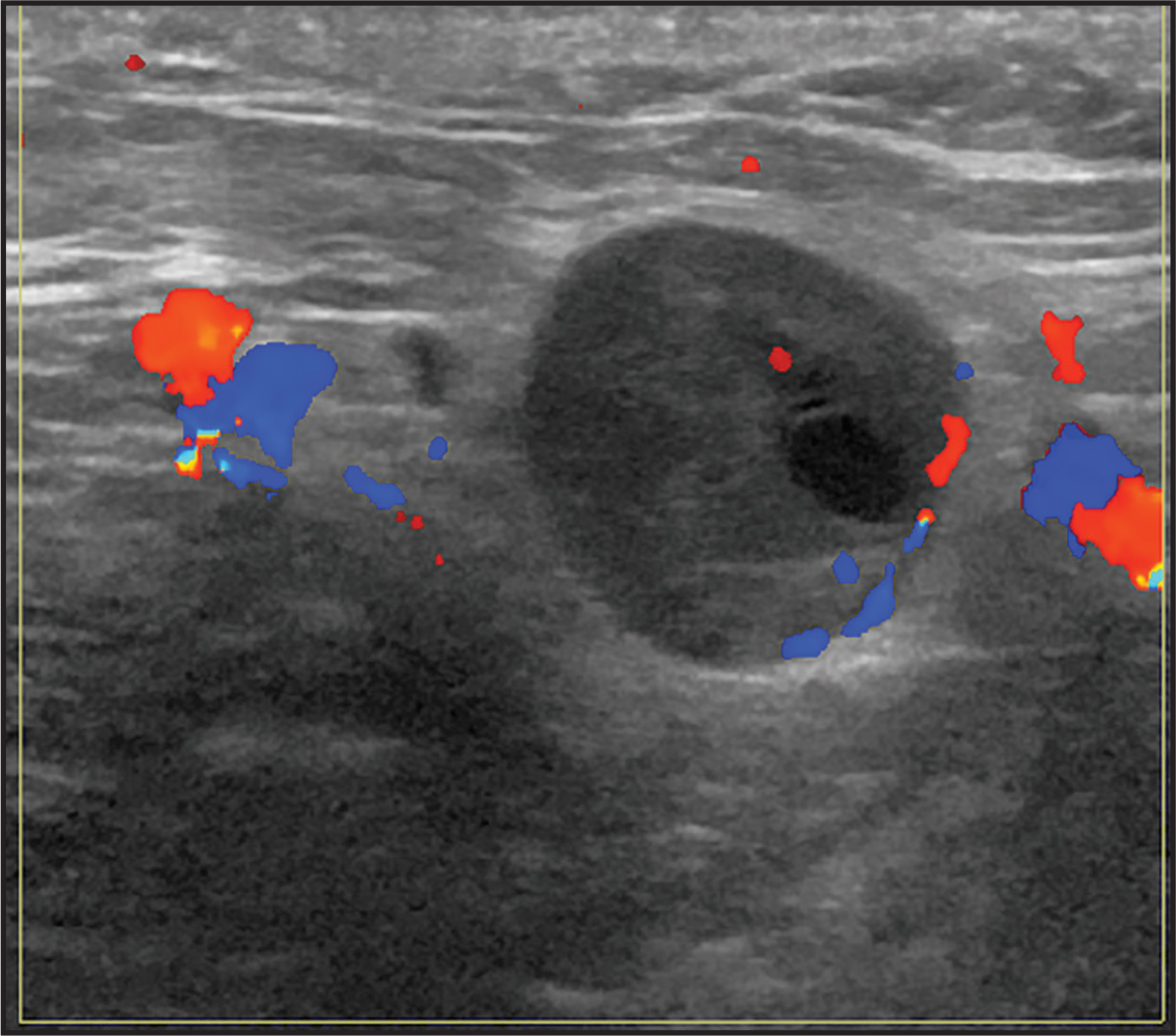 FIGURE 15