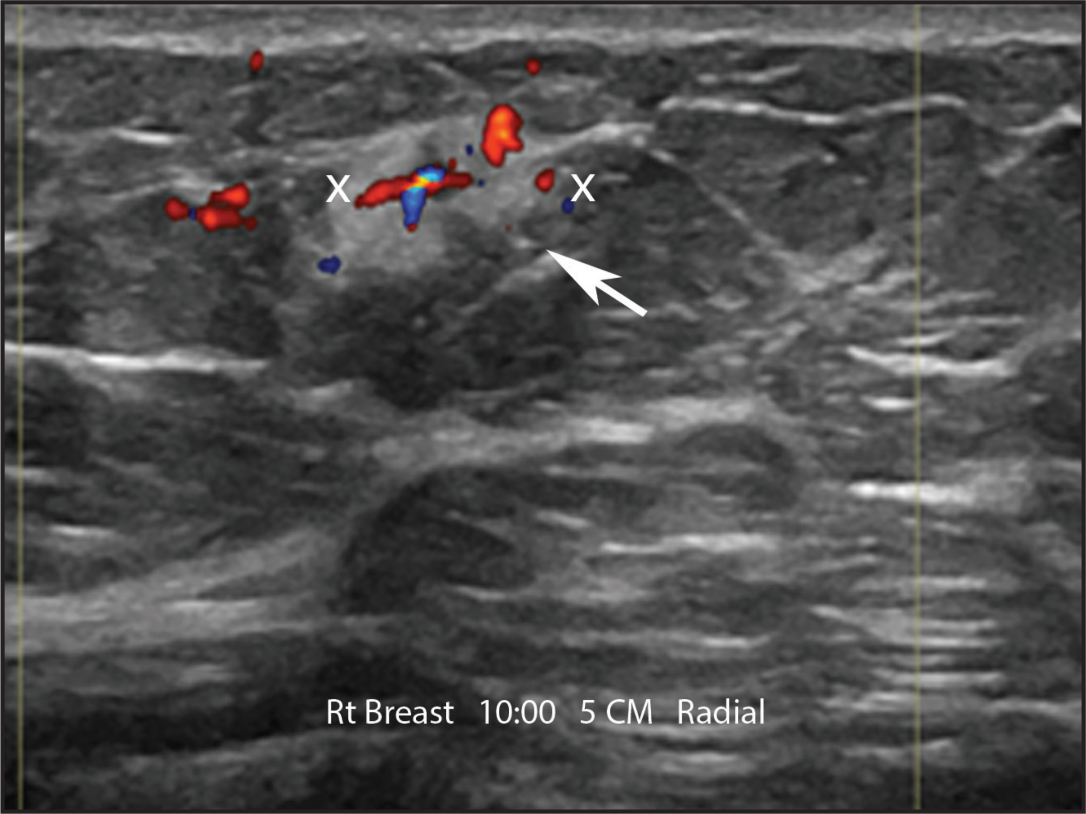 FIGURE 16