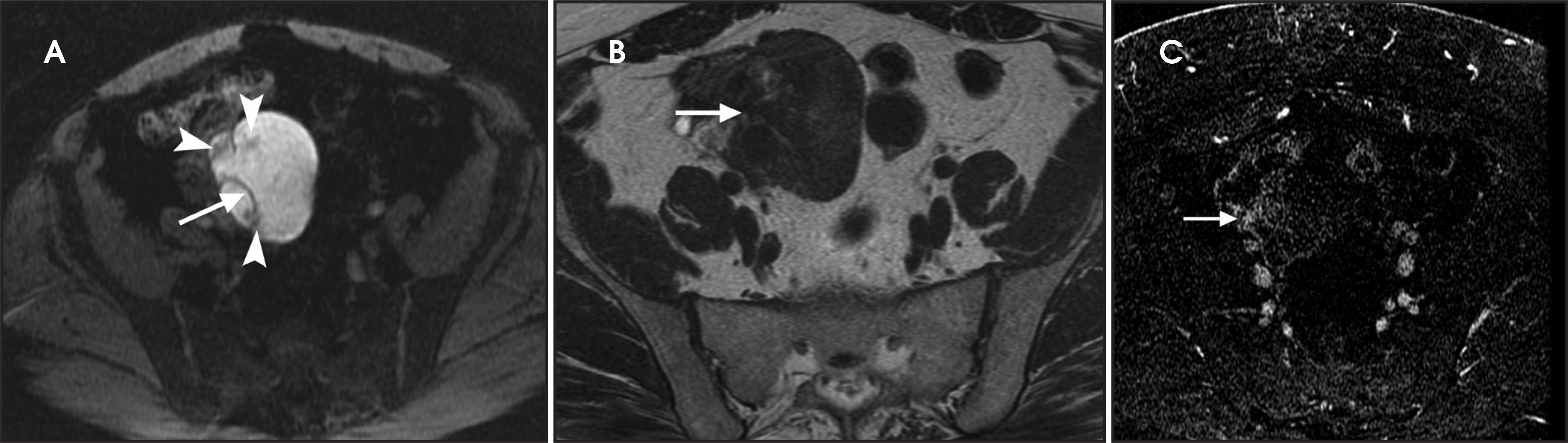 FIGURE 3