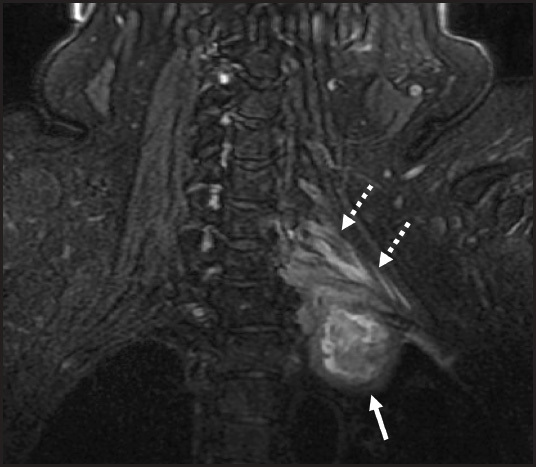 FIGURE 9.