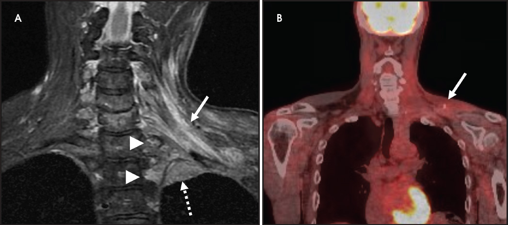 FIGURE 11.