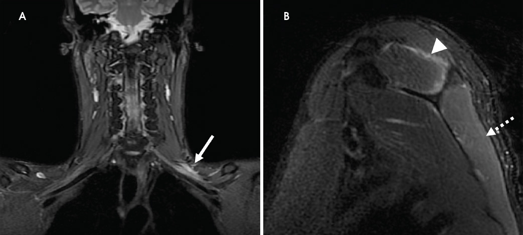 FIGURE 13.