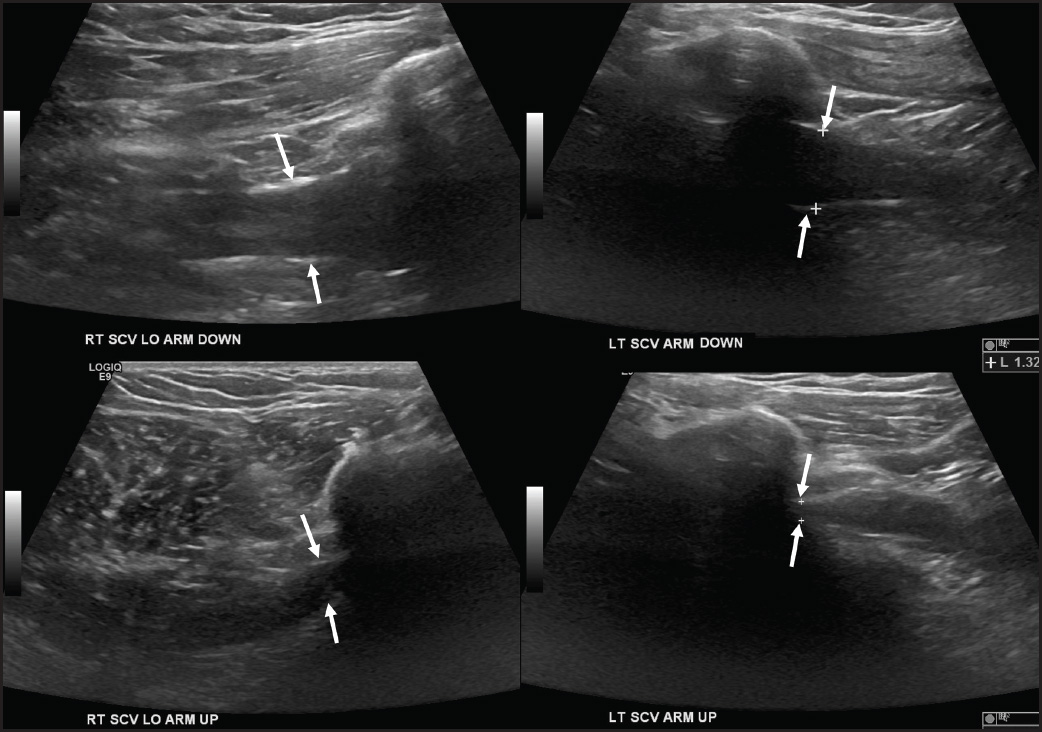FIGURE 14.