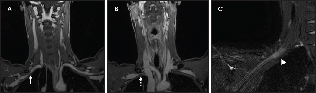 FIGURE 16.