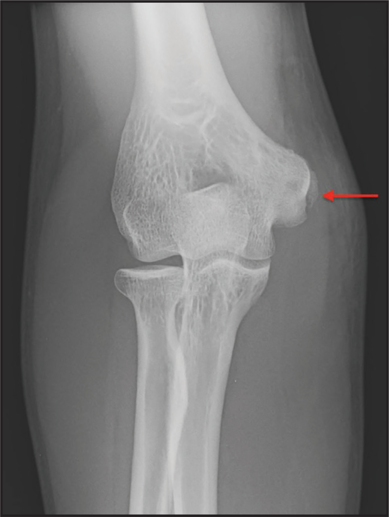 FIGURE 1