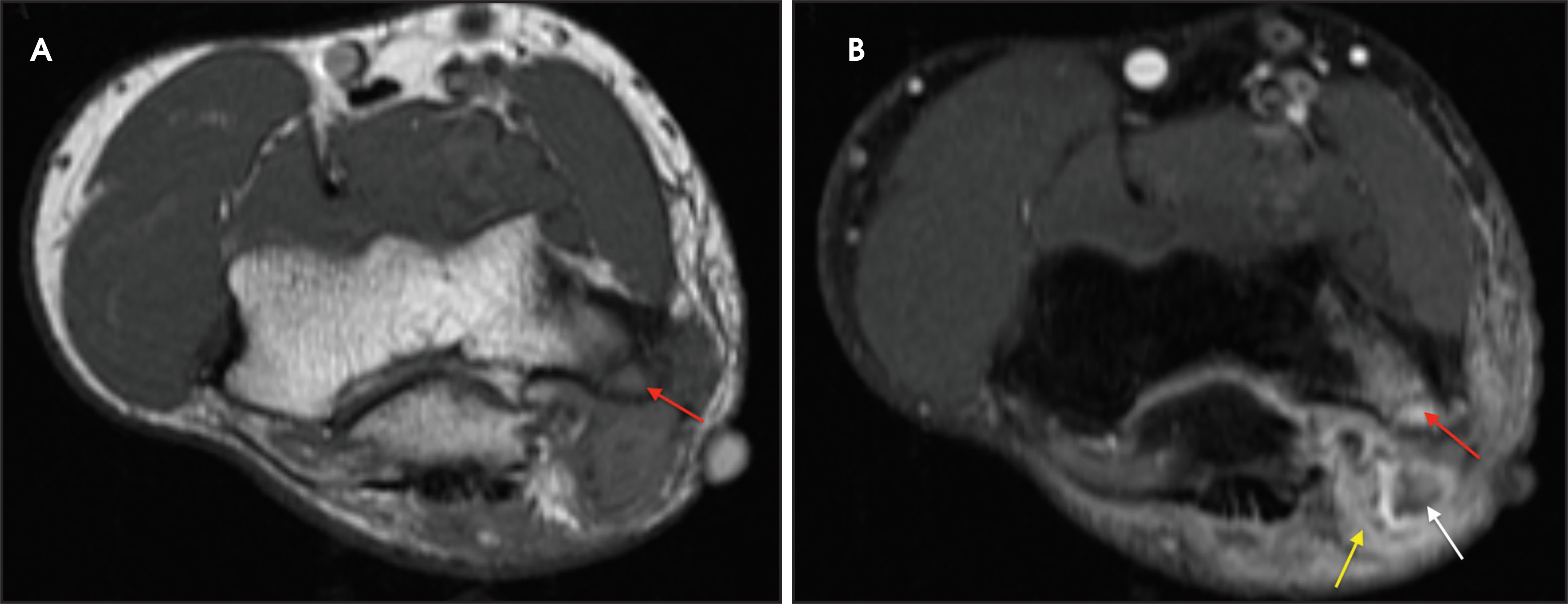 FIGURE 3