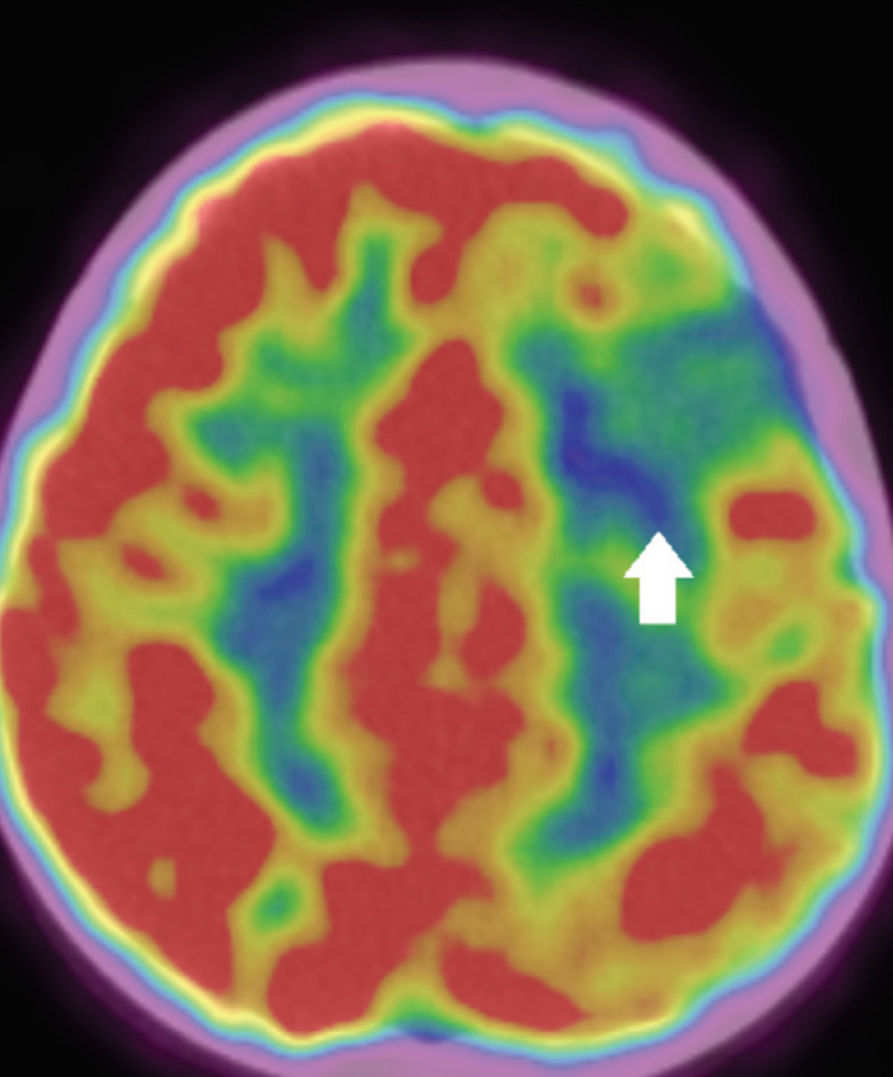 FIGURE 3