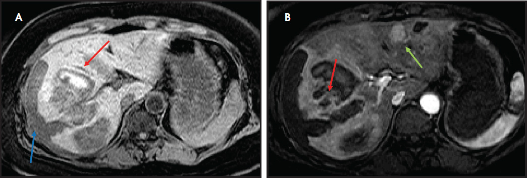 FIGURE 5.