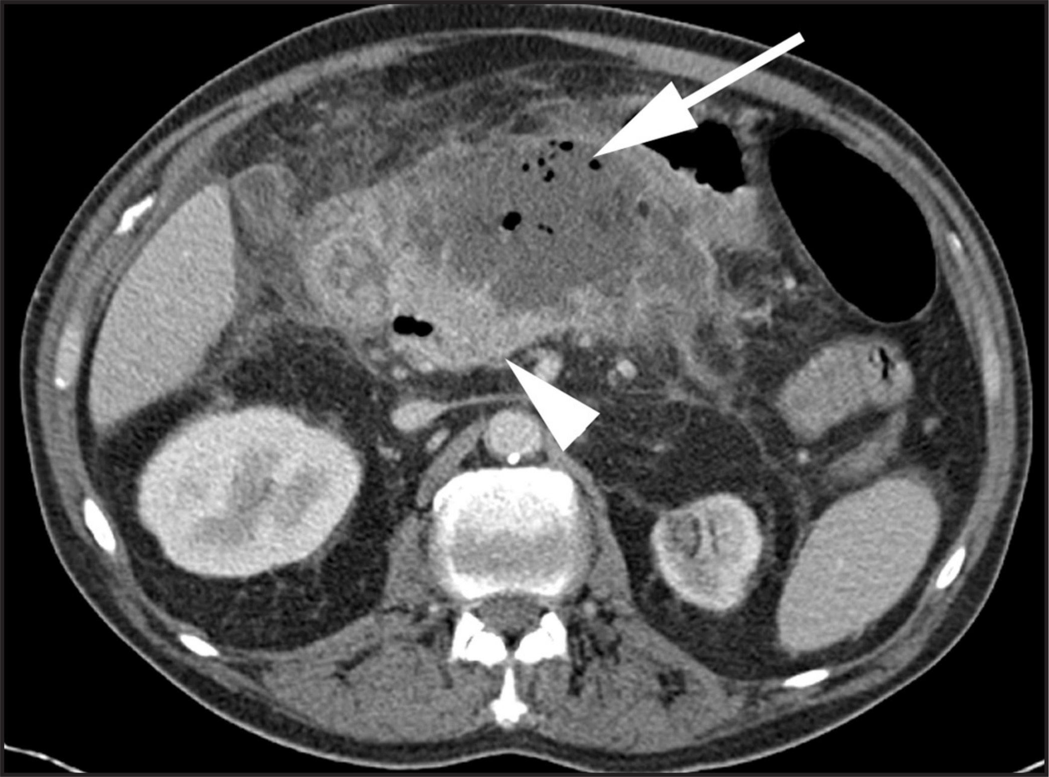 FIGURE 4.