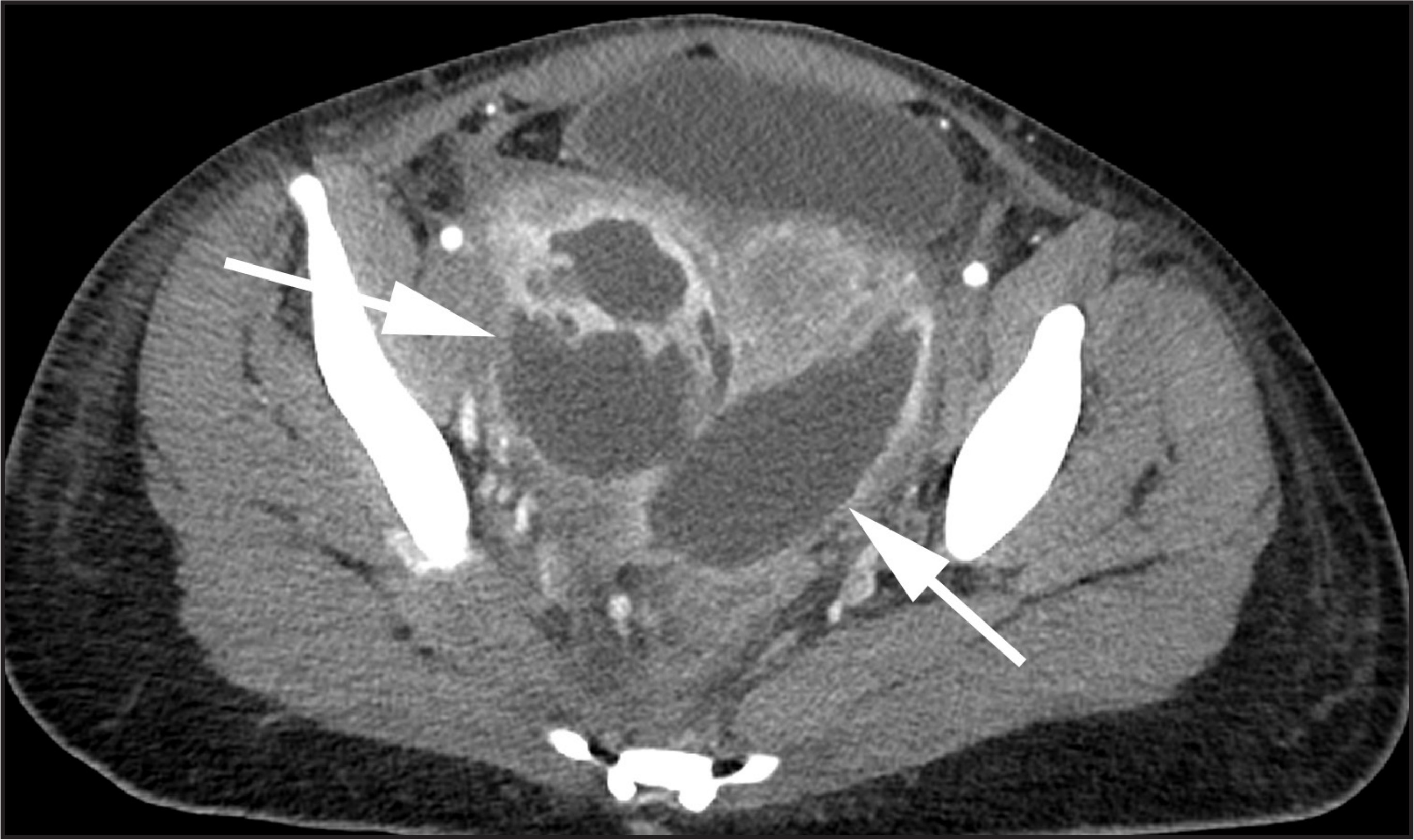 FIGURE 11.