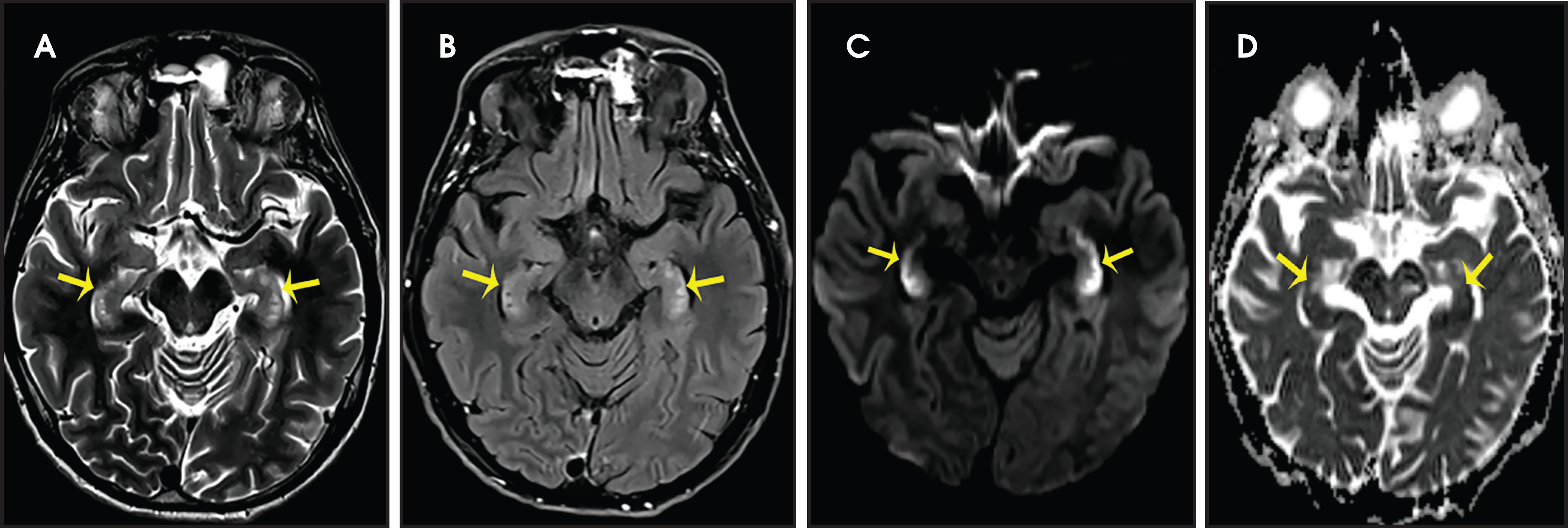 FIGURE 11.