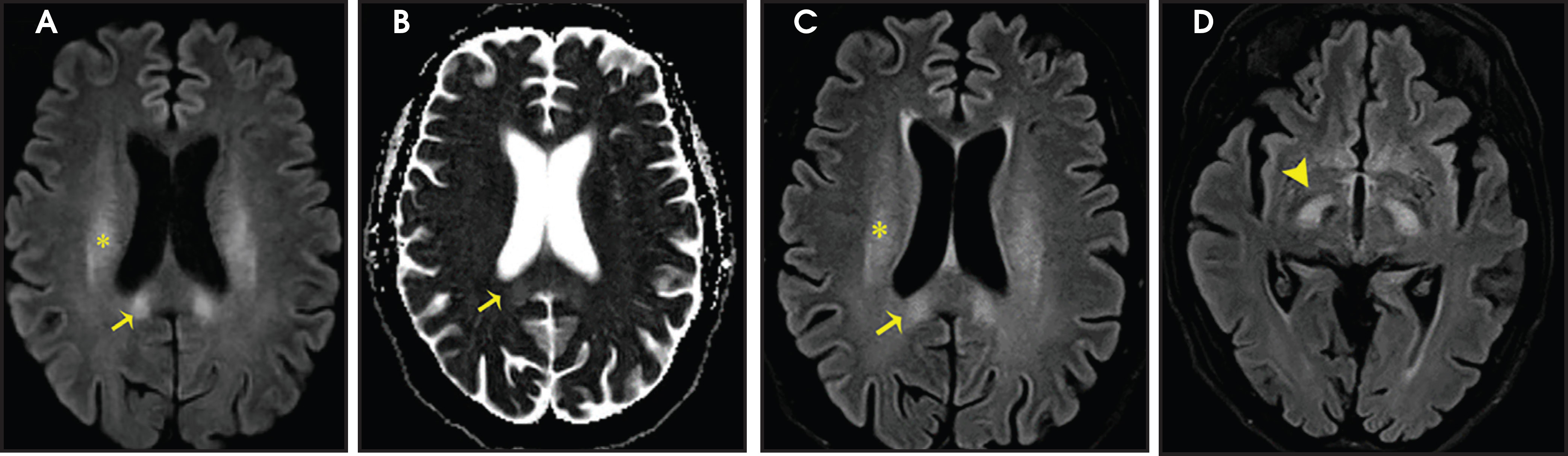 FIGURE 13.