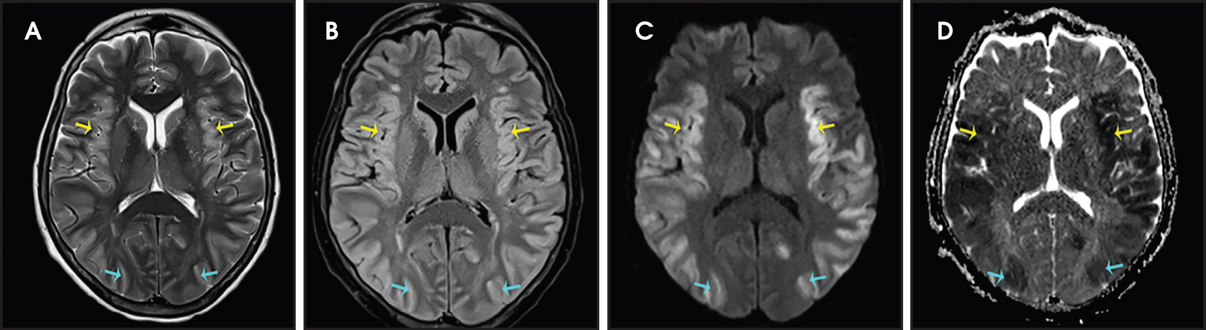 FIGURE 14.
