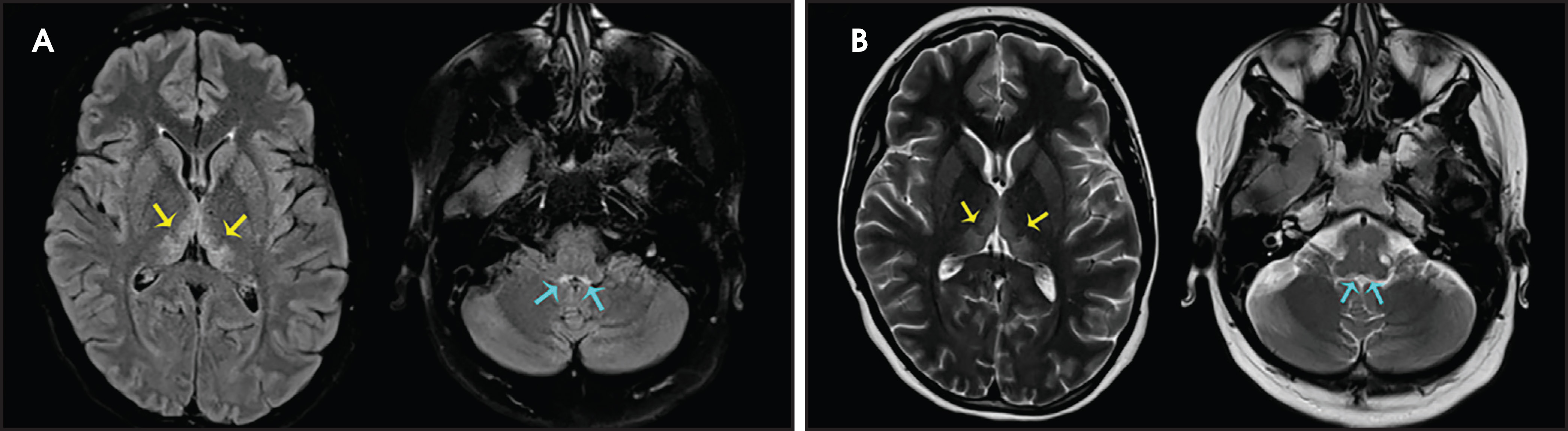 FIGURE 16.