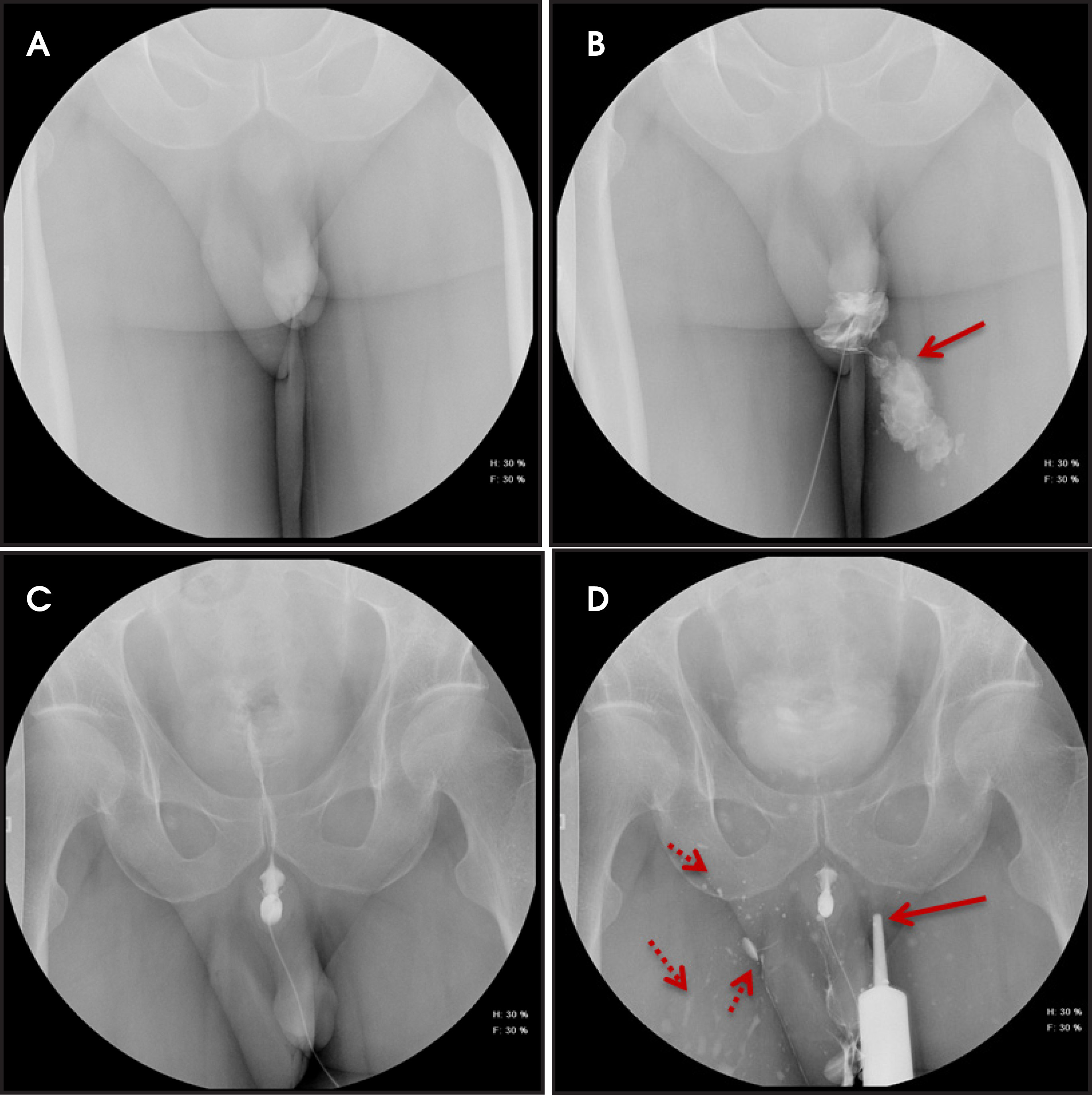 FIGURE 3.