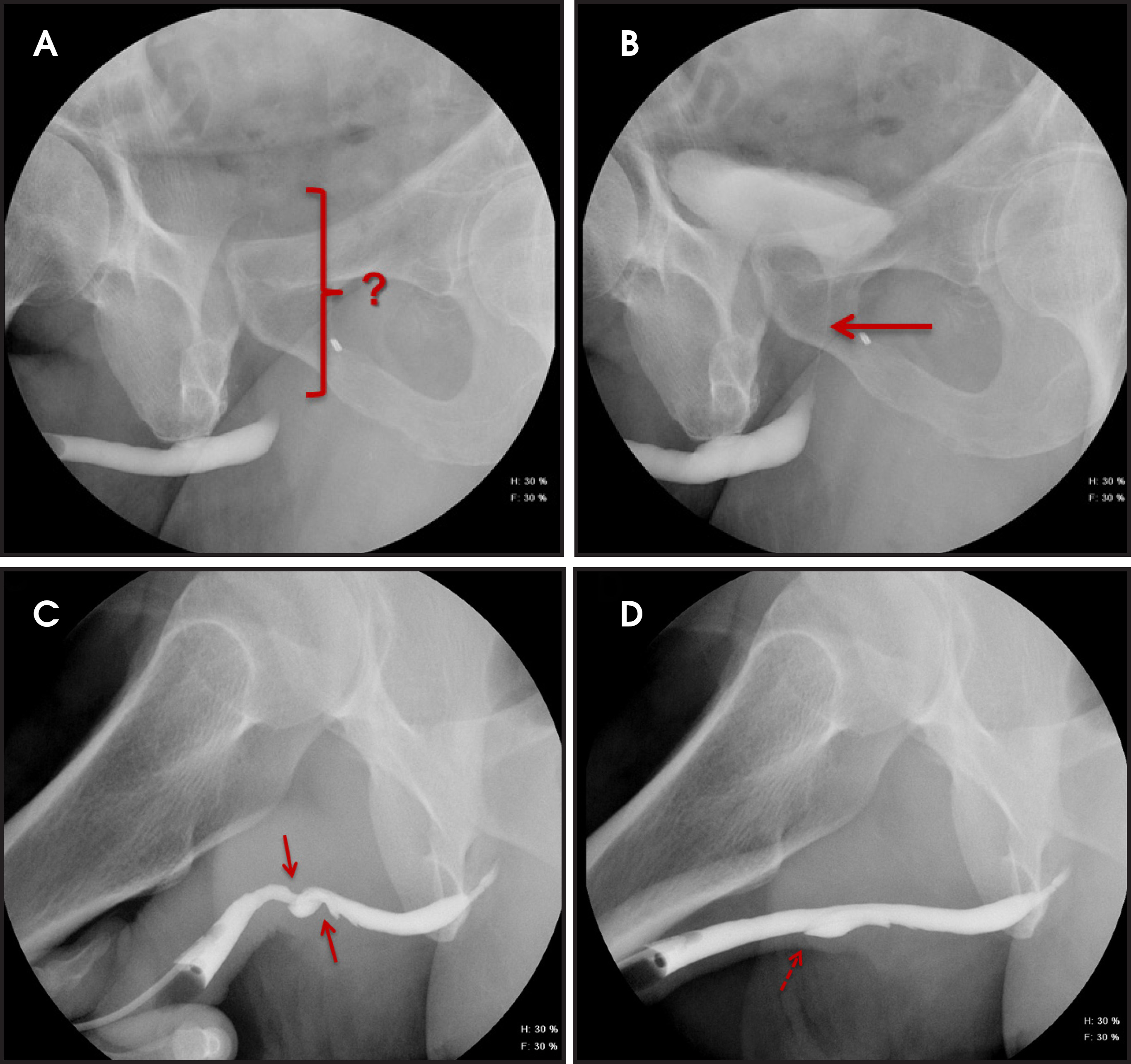 FIGURE 4.