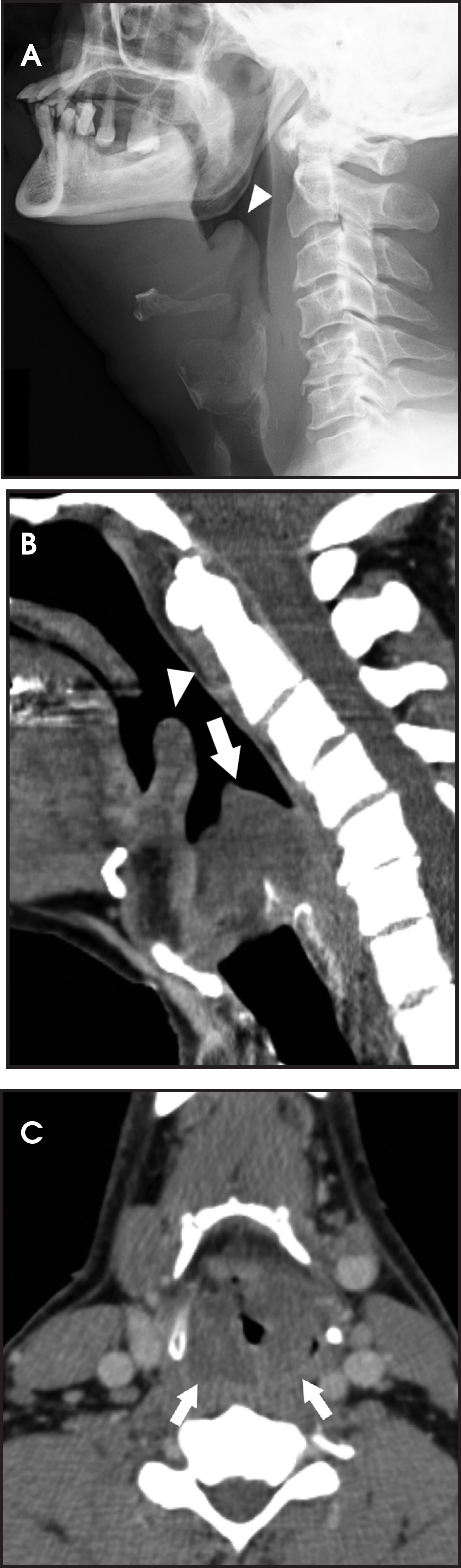 FIGURE 11.