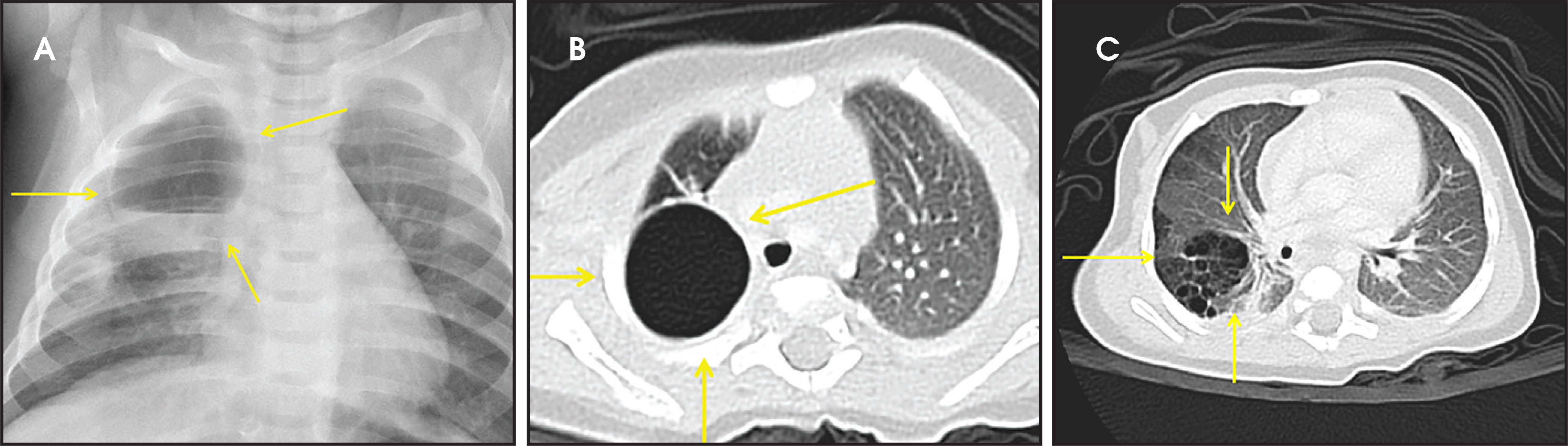 FIGURE 3.