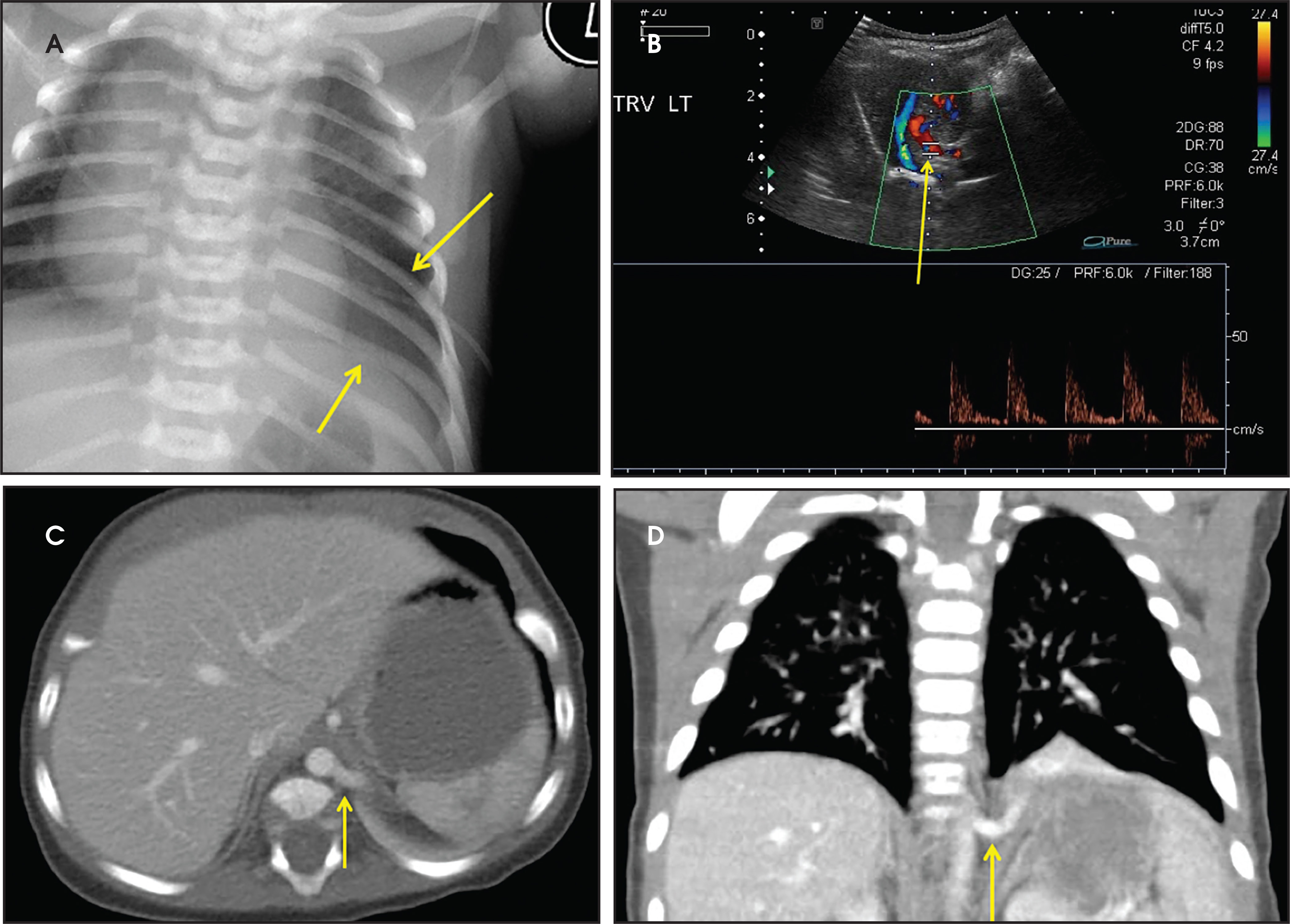 FIGURE 4.
