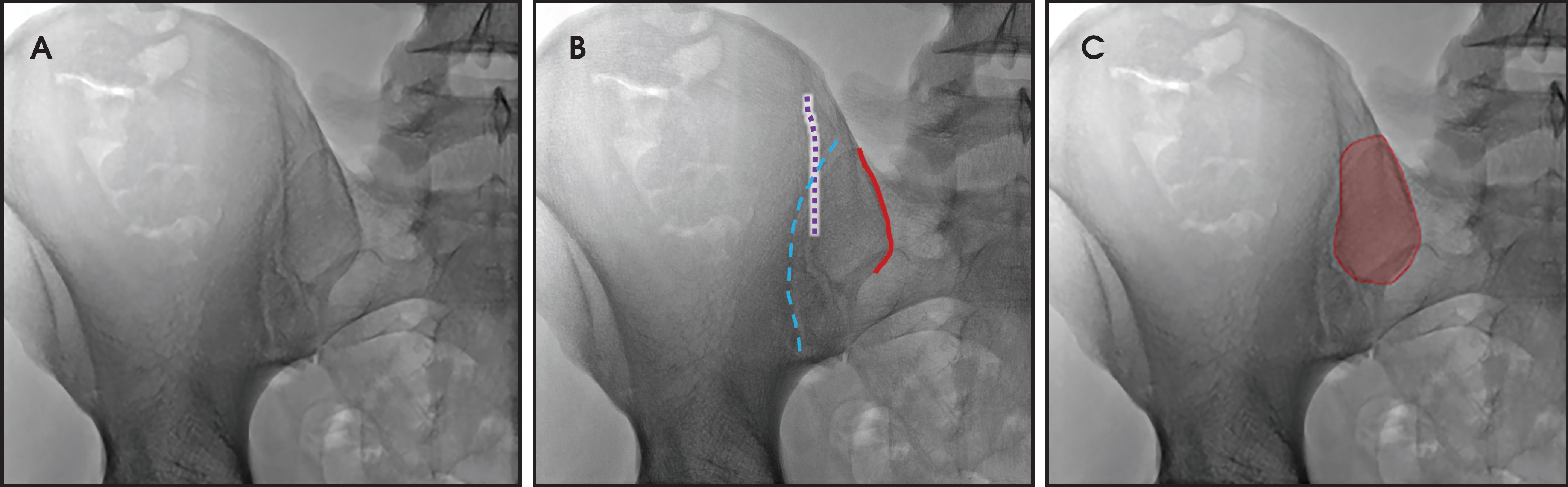 FIGURE 3.
