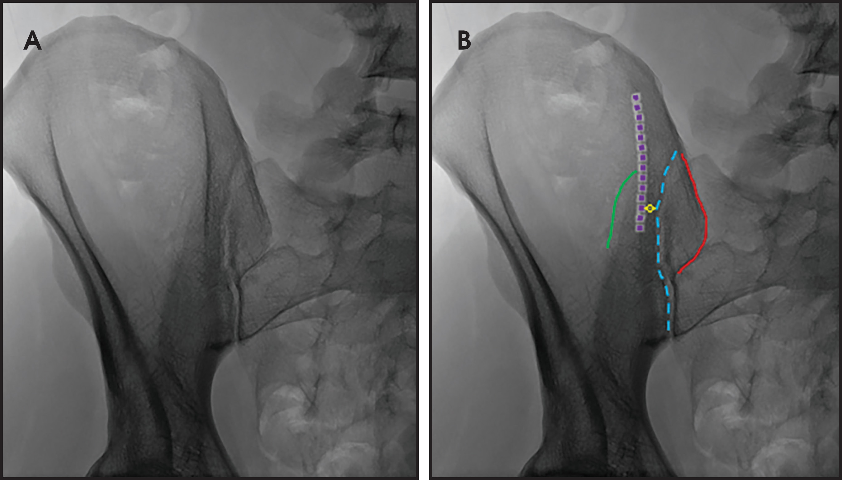 FIGURE 4.