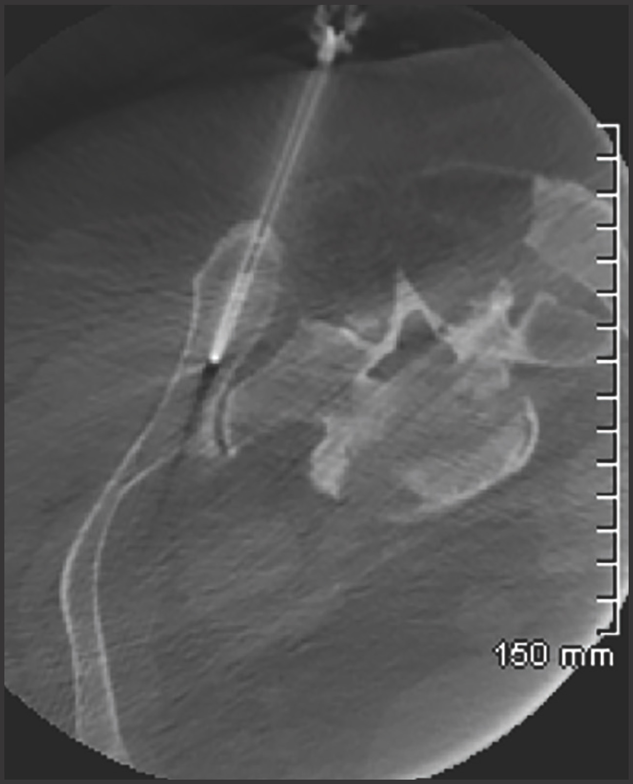 FIGURE 11.