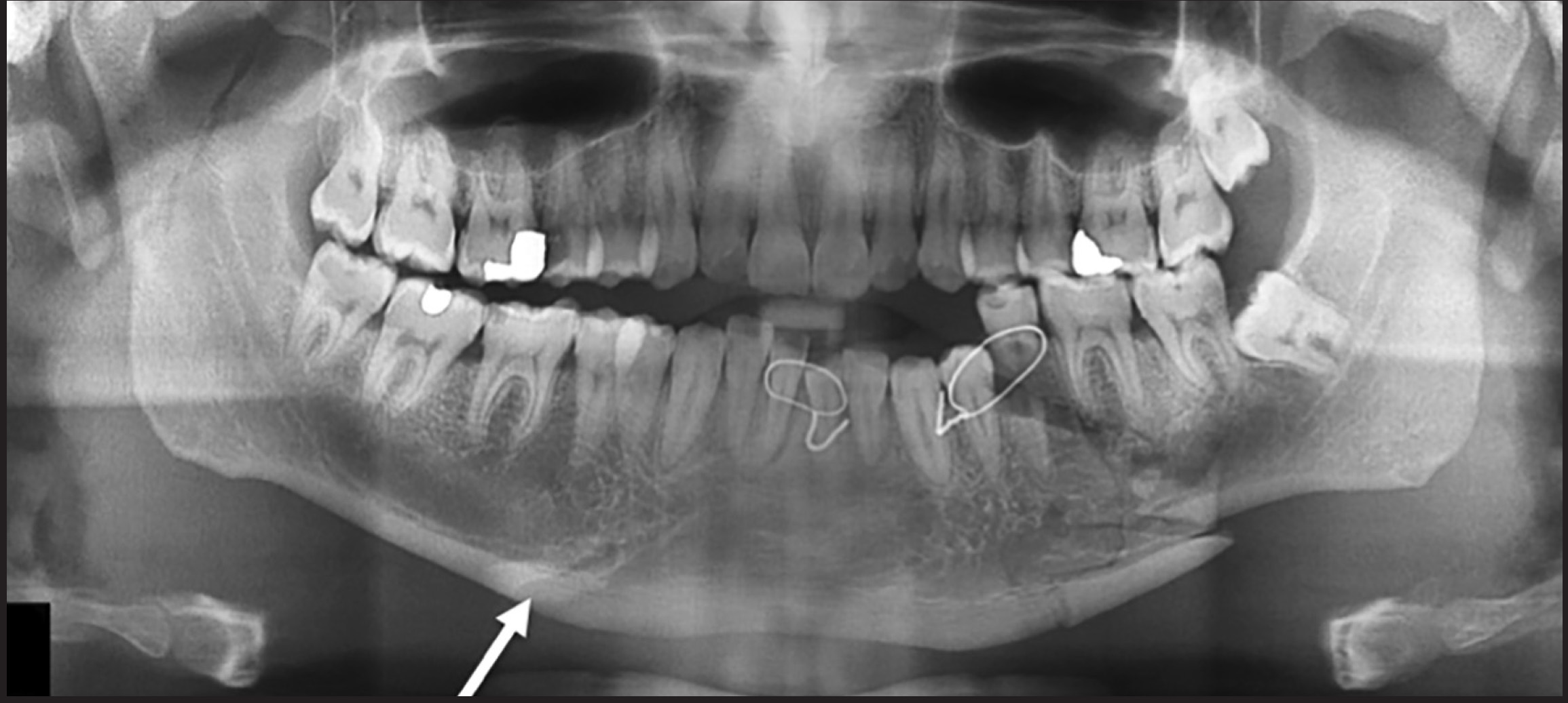 FIGURE 3.