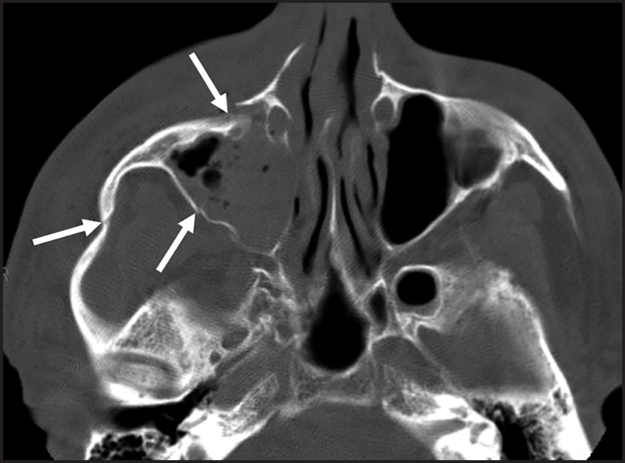 FIGURE 10.