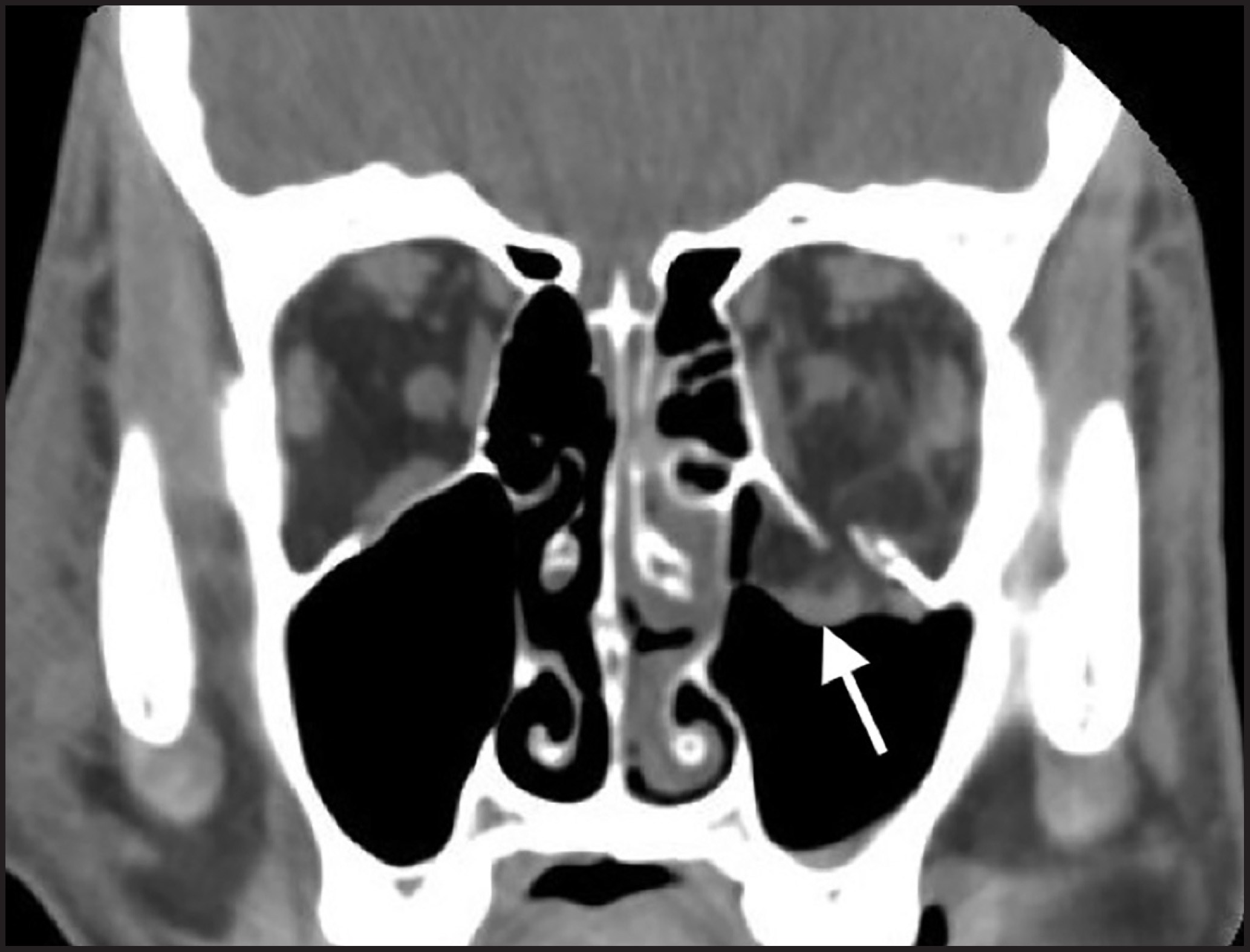 FIGURE 11.