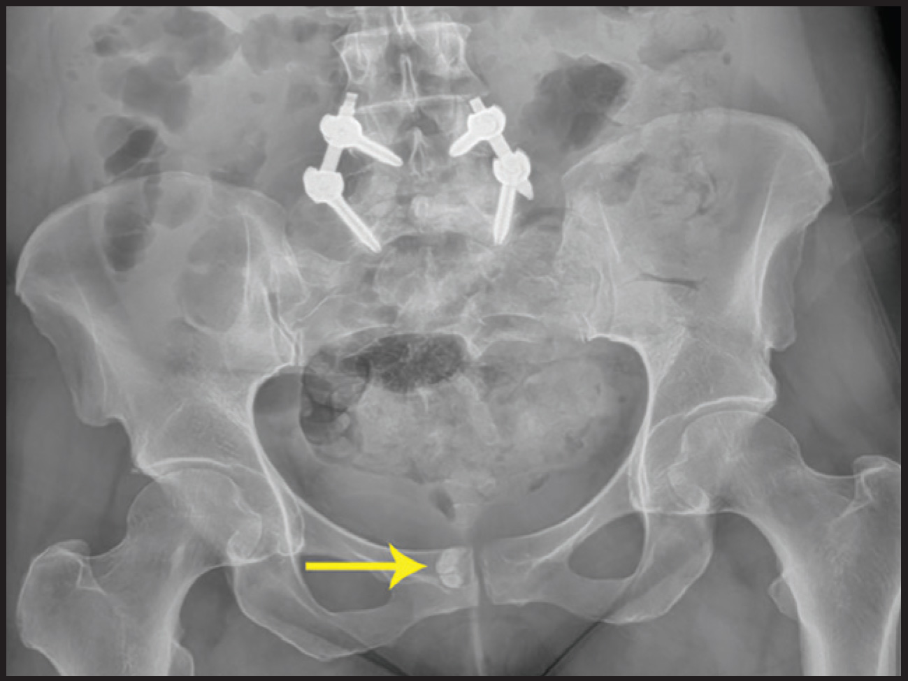 FIGURE 3.