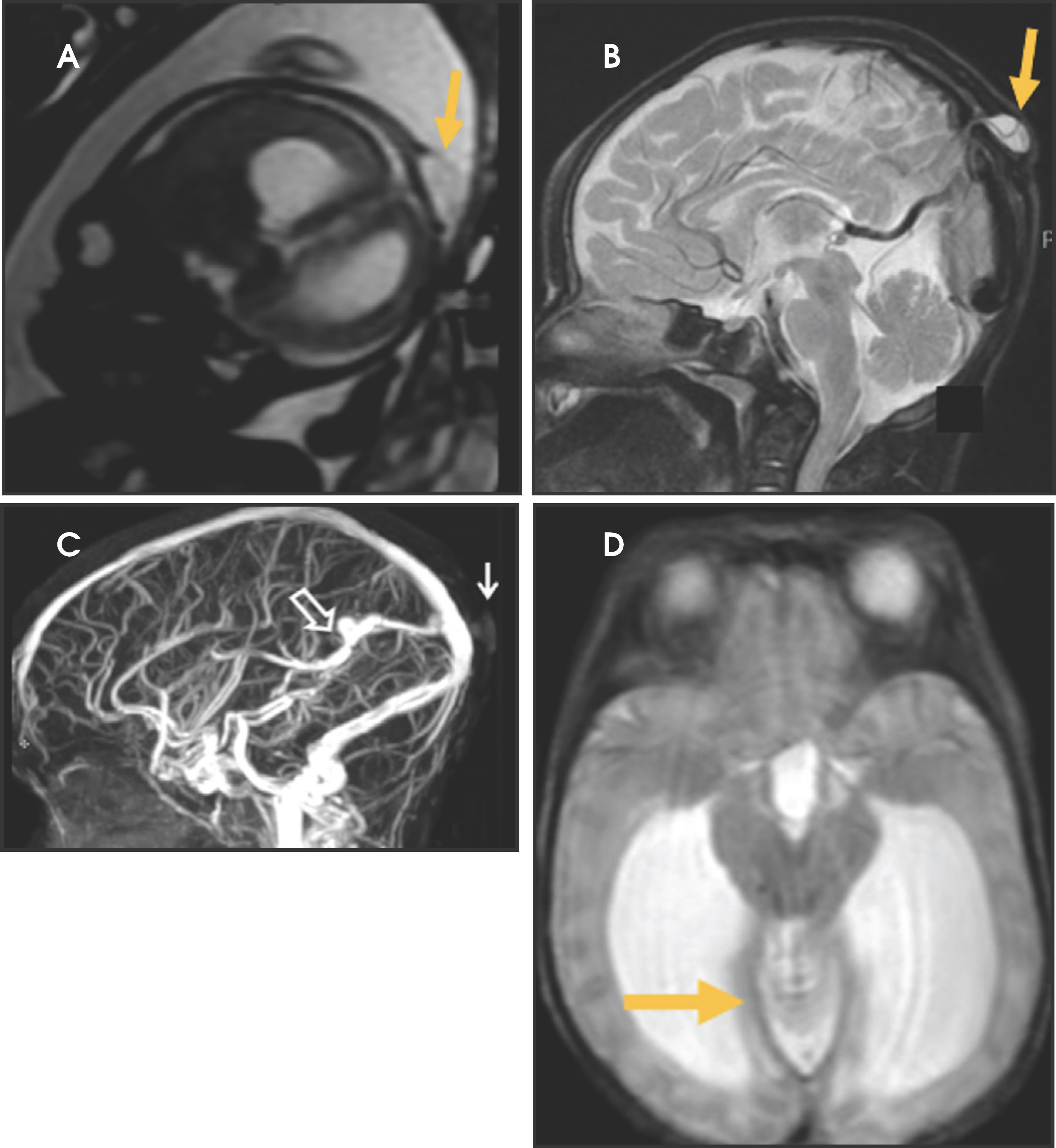 FIGURE 4.