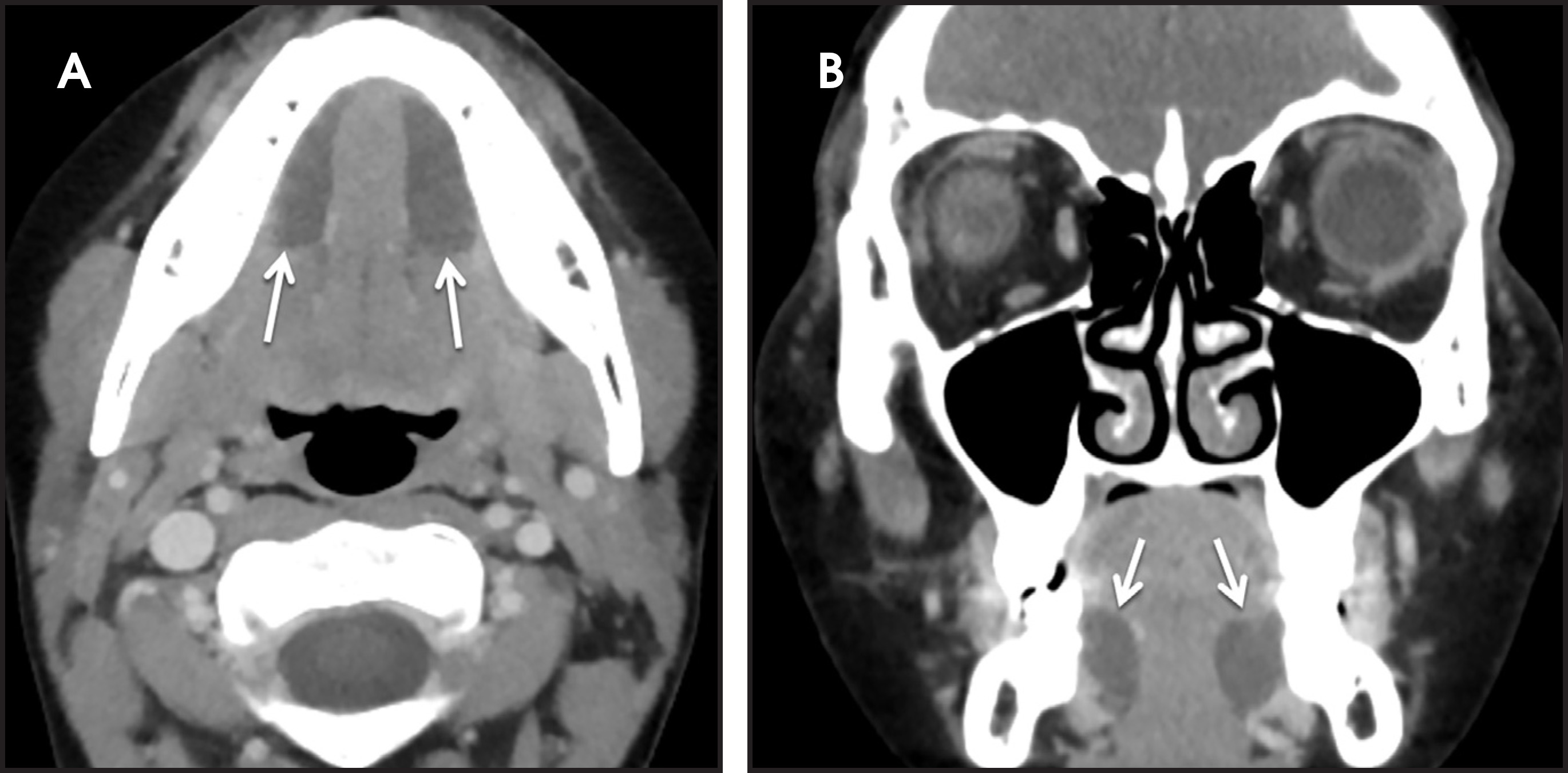 FIGURE 3.