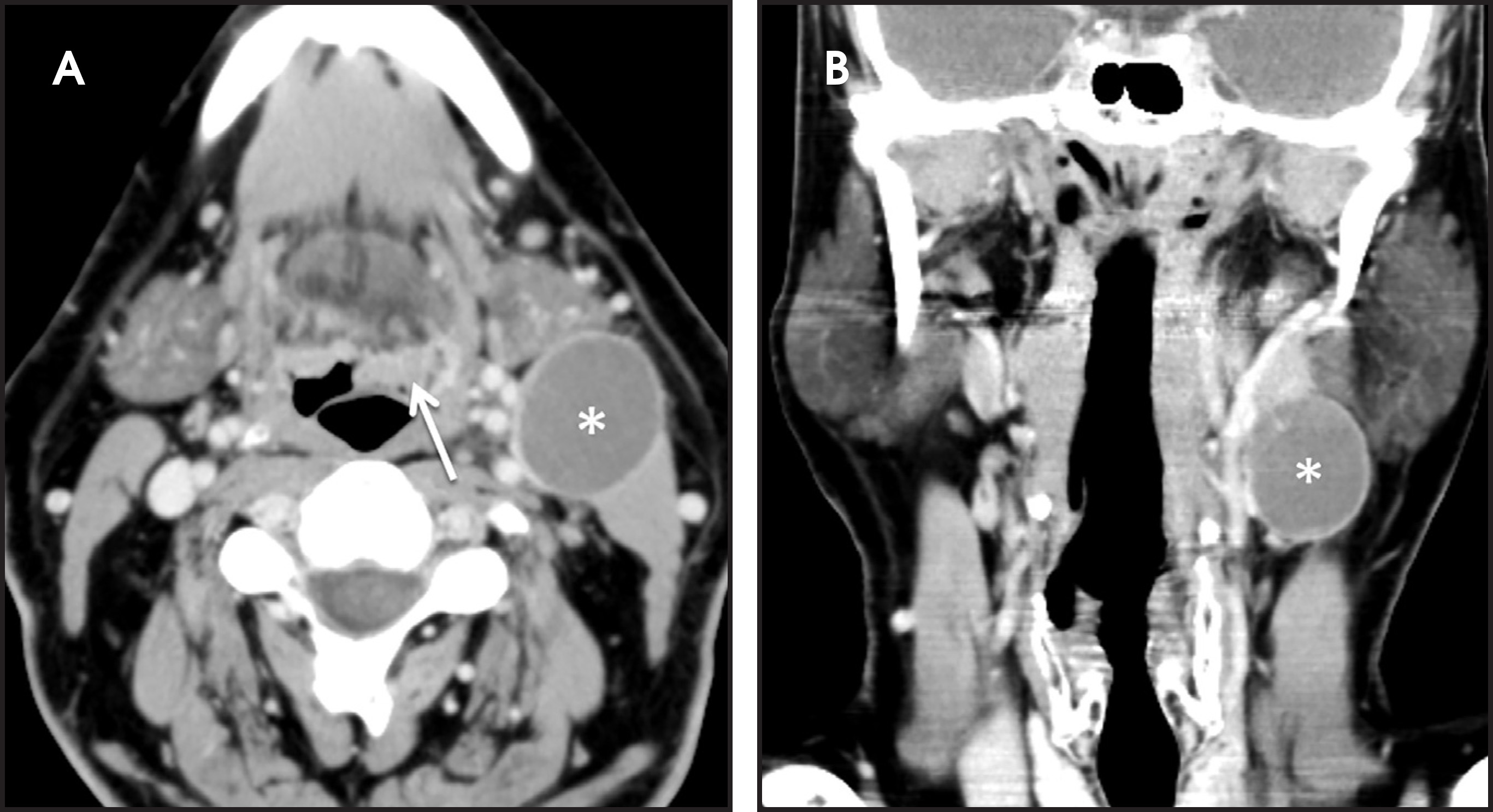 FIGURE 11.