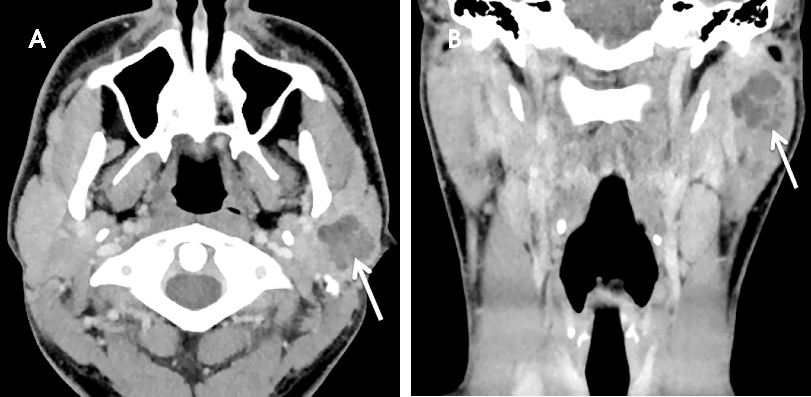 FIGURE 13.