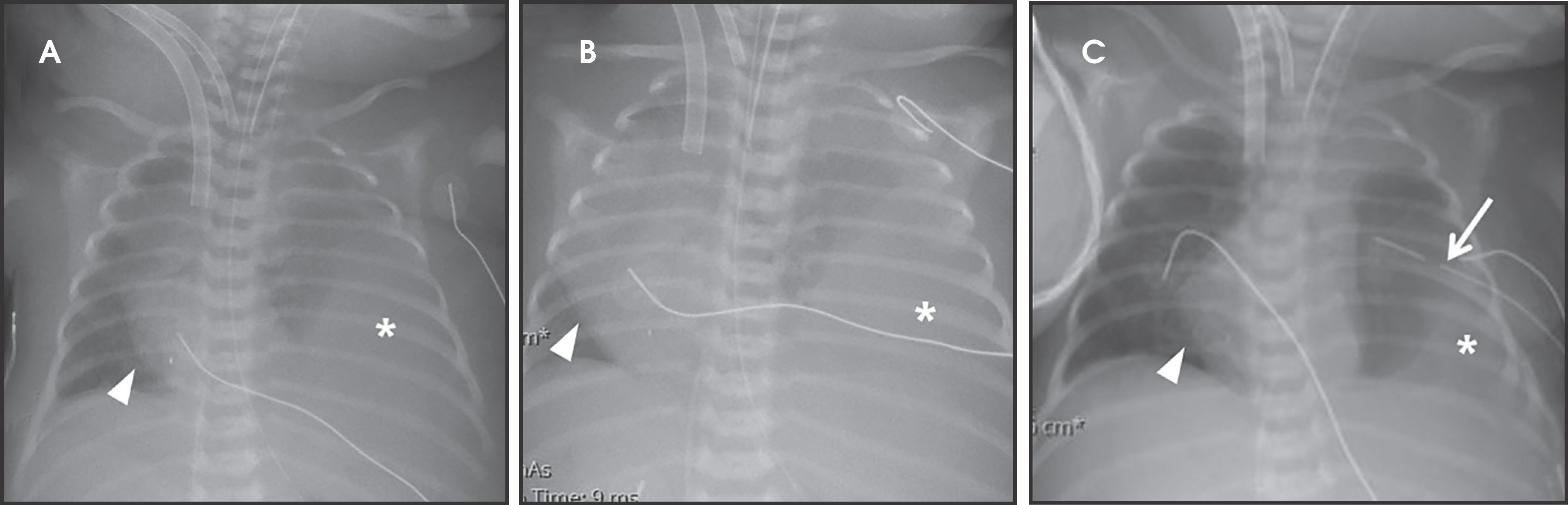 FIGURE 4.