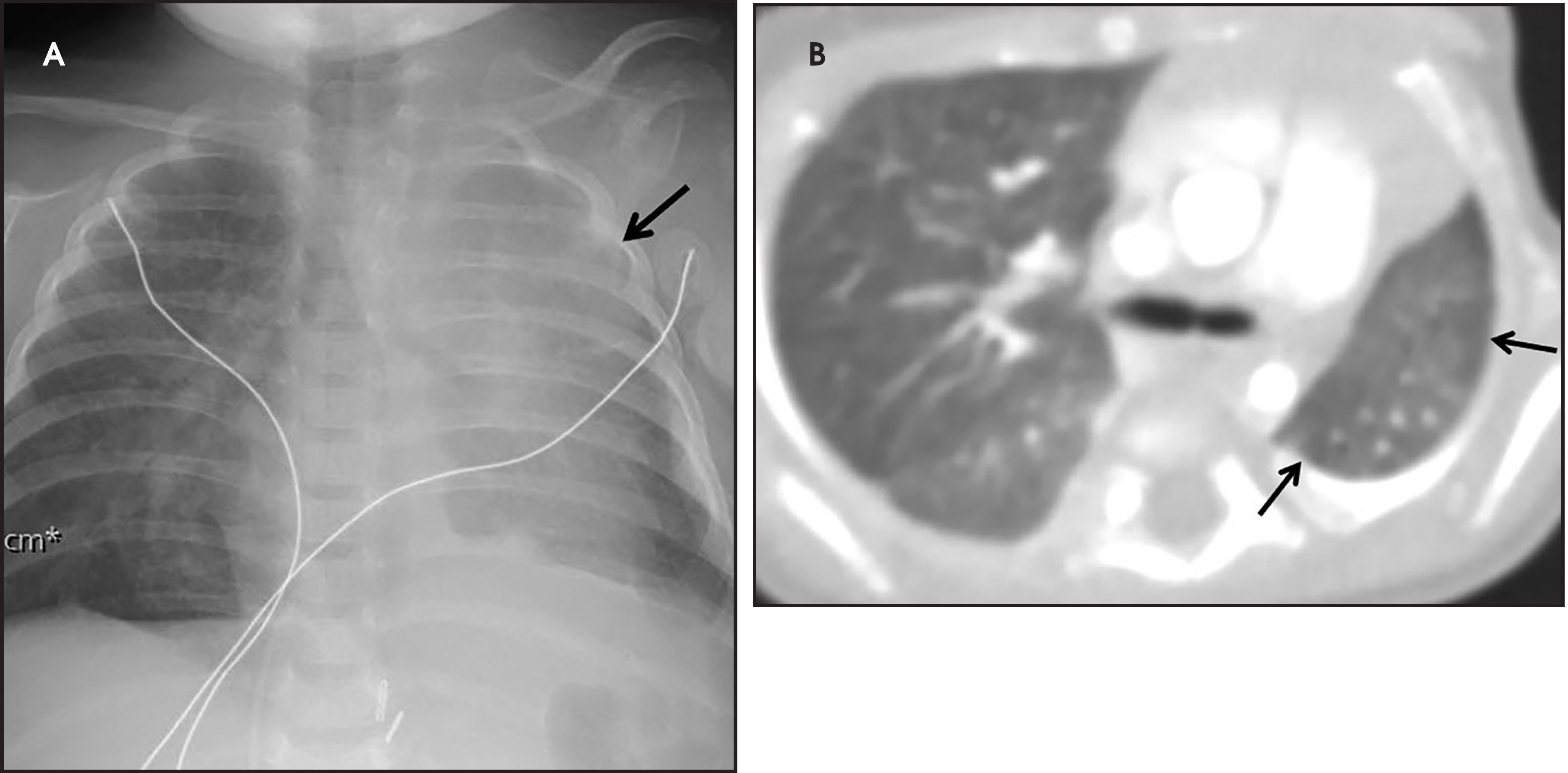 FIGURE 11.