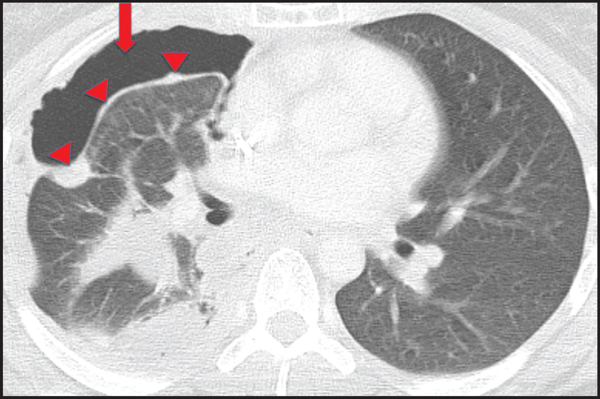 FIGURE 9.