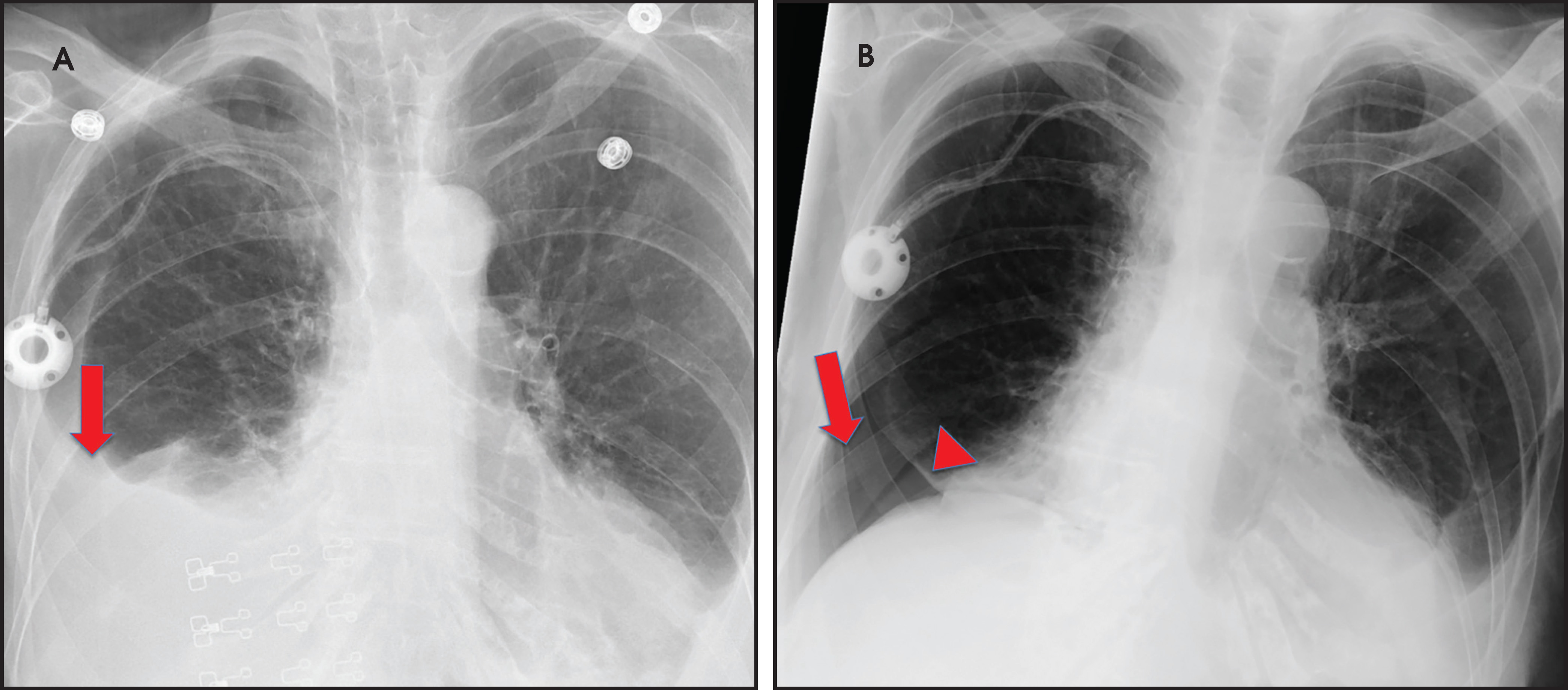 FIGURE 10.