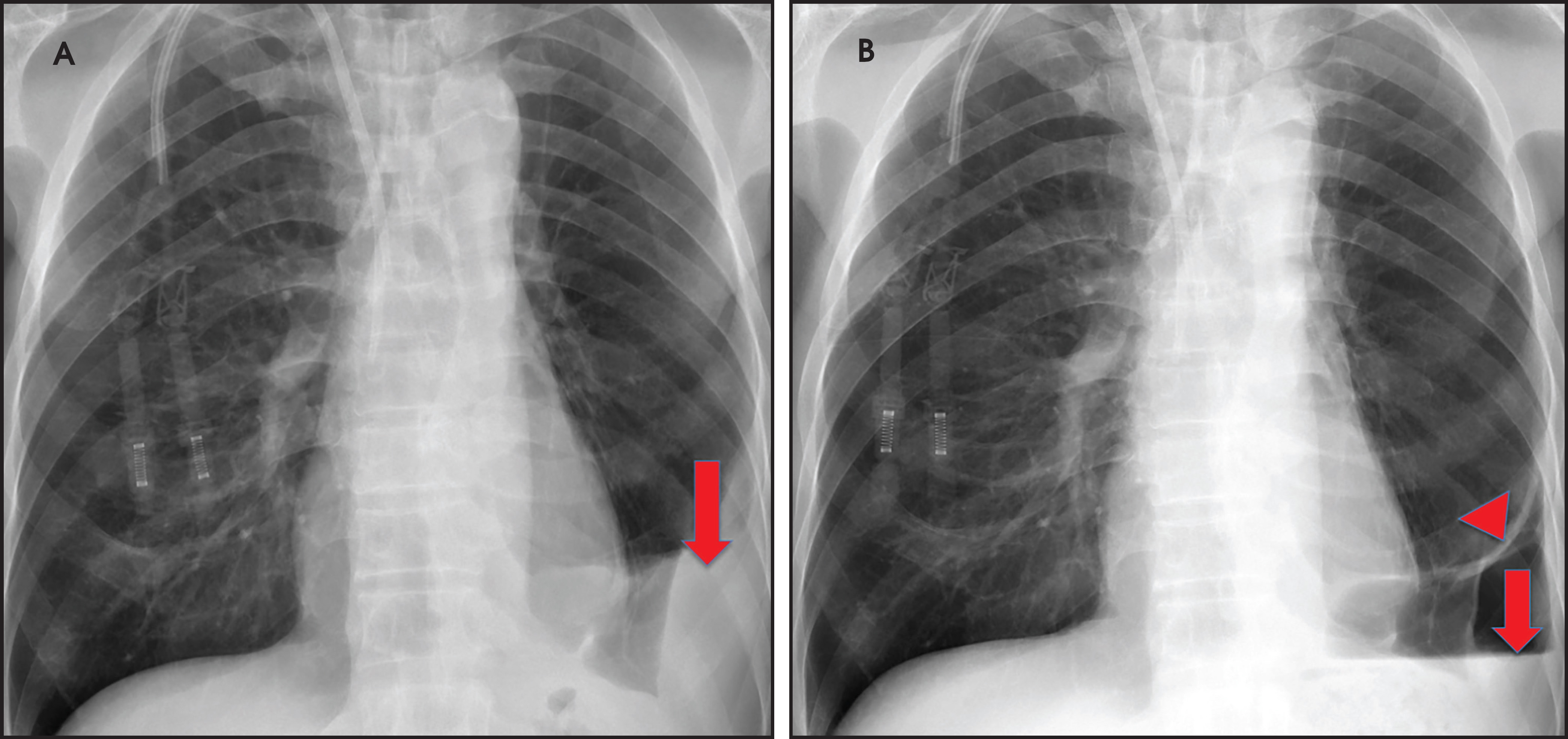 FIGURE 11.
