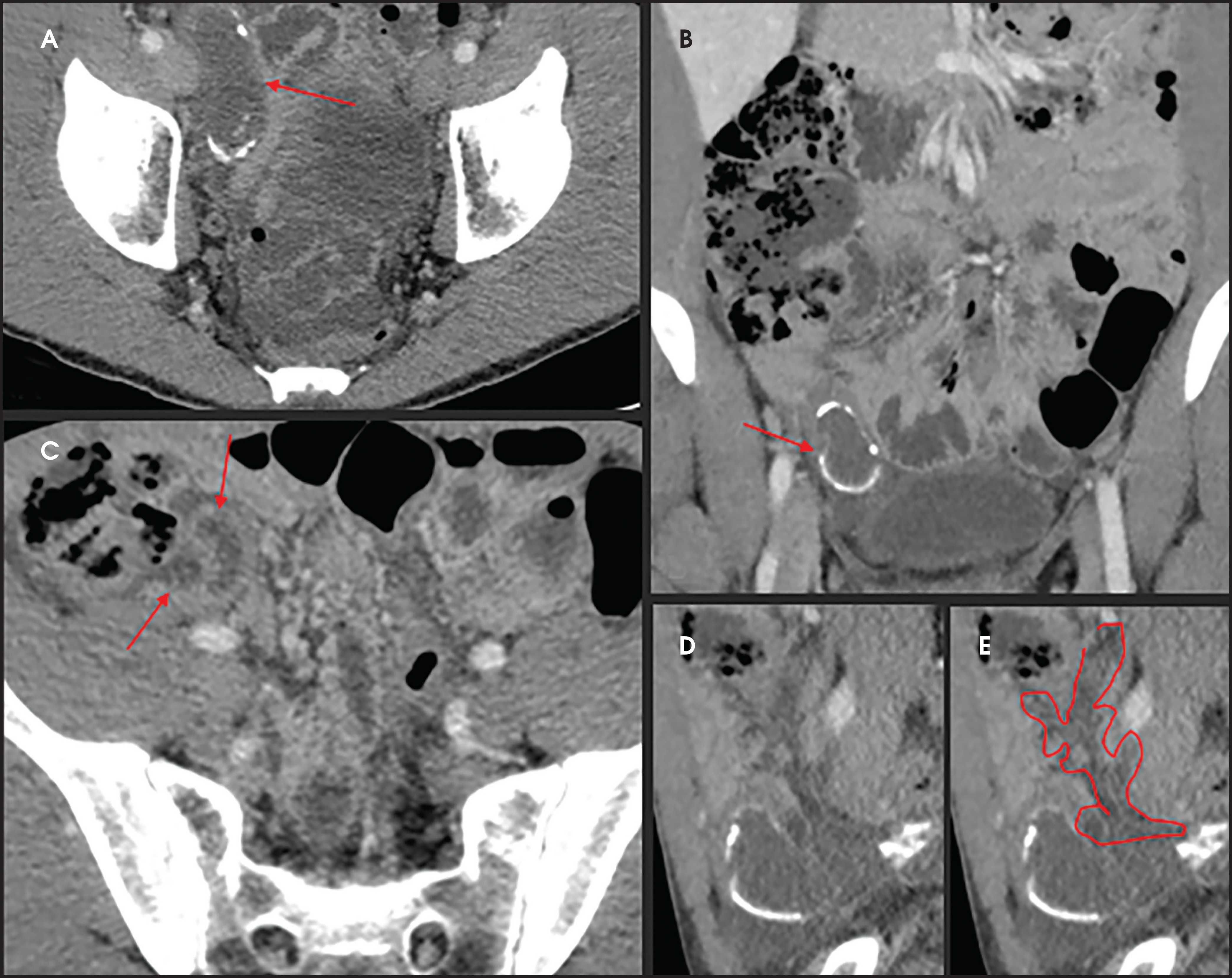 FIGURE 2.